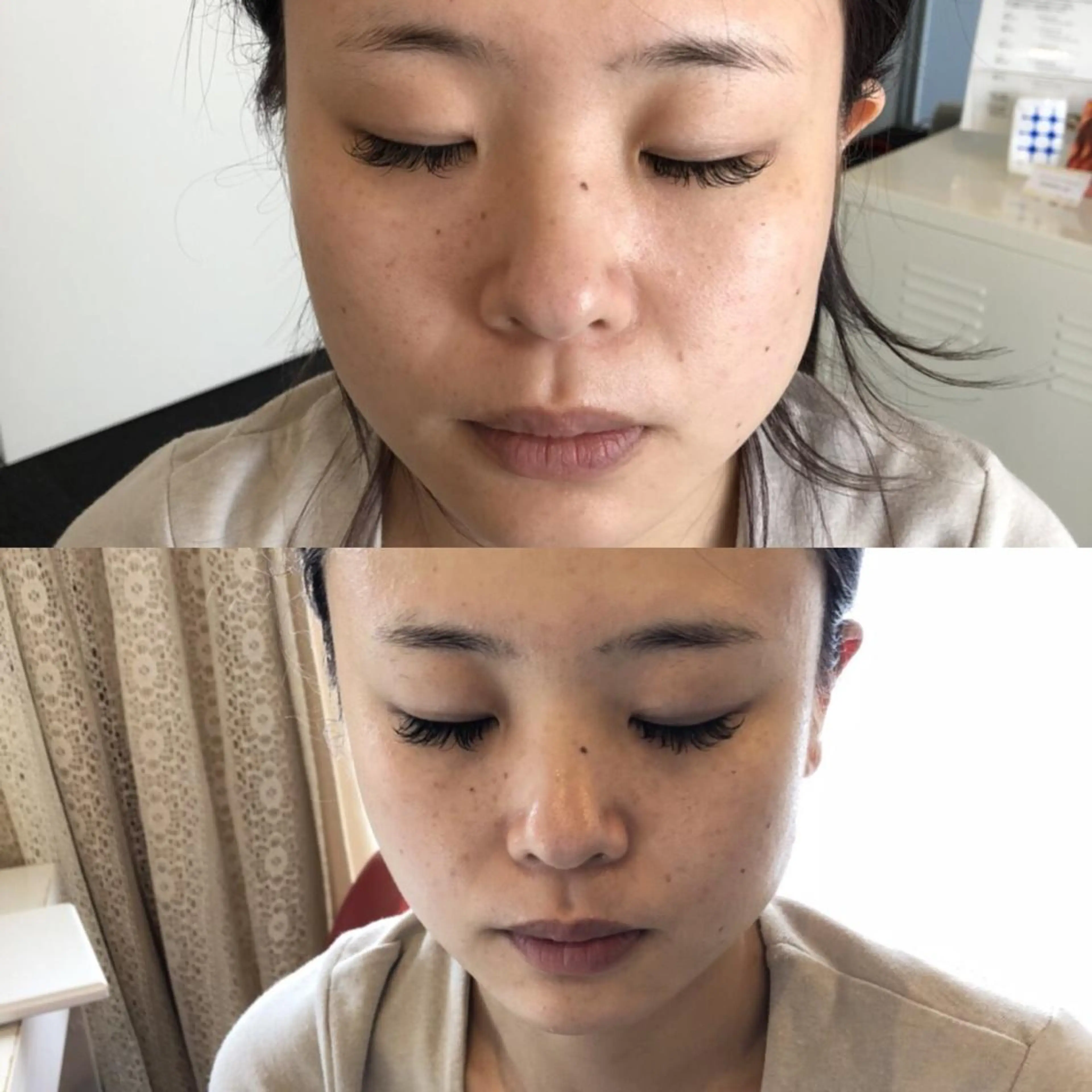 毛穴/ピーリング ララピール/POLAのエステ・リラクイメージ