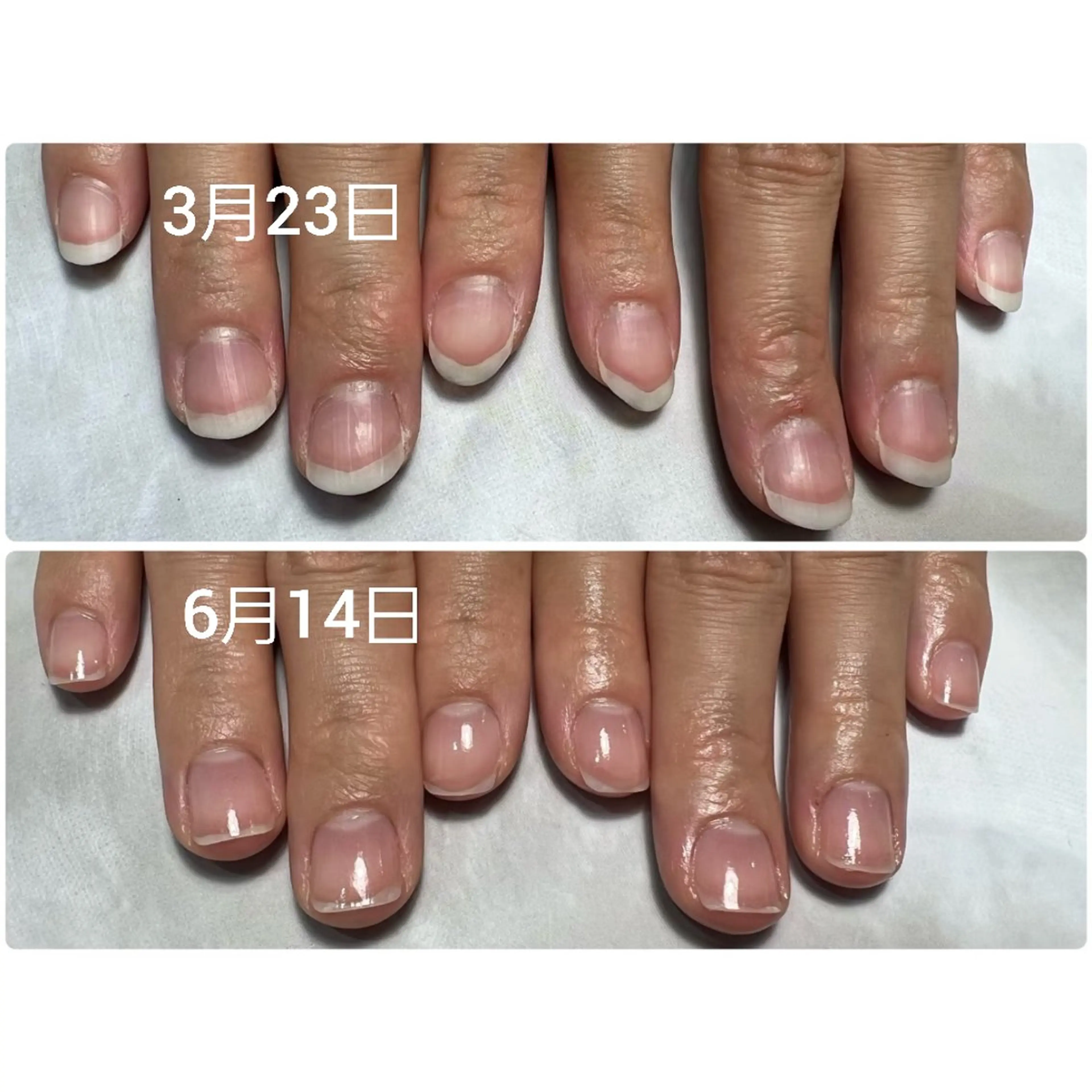 ネイル ジェルネイル ハンドケア AKT NAIL所属・AKT Beauty エステヘッドスパのエステ・リラクイメージ