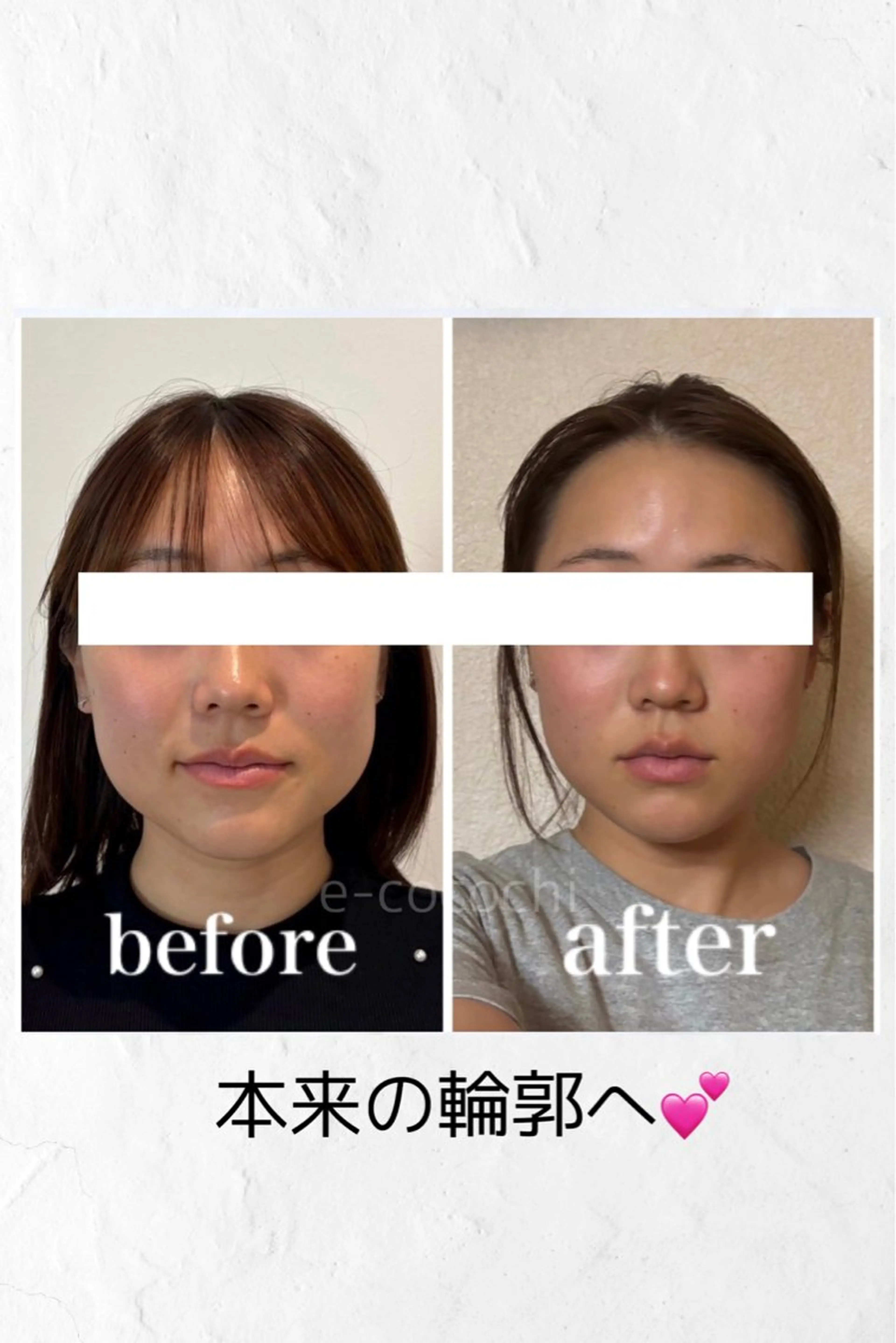 エステ リラク 小顔と ヘッドスパのお店のエステ・リラクイメージ