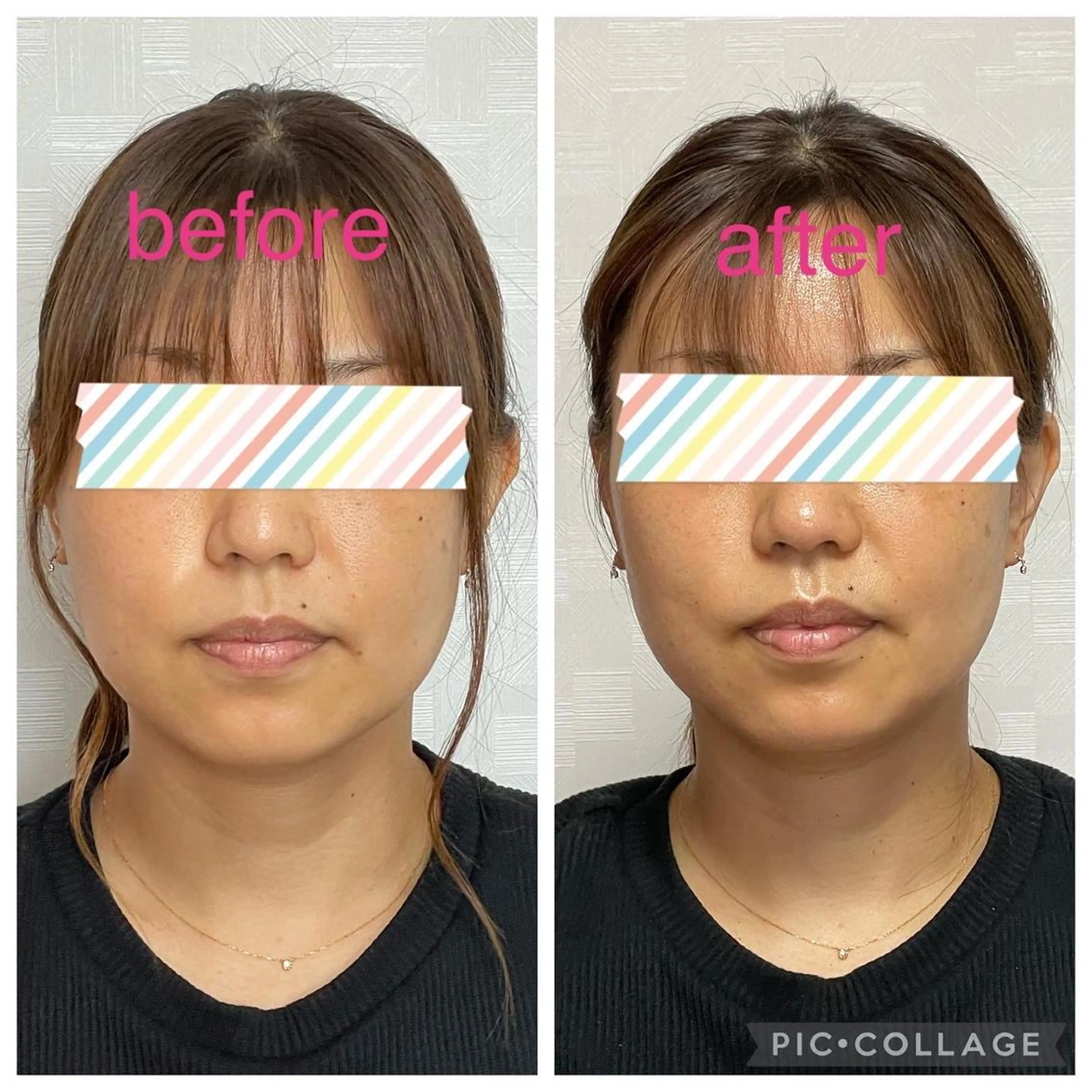 Raviliss ラヴィリスのエステ・リラクイメージ