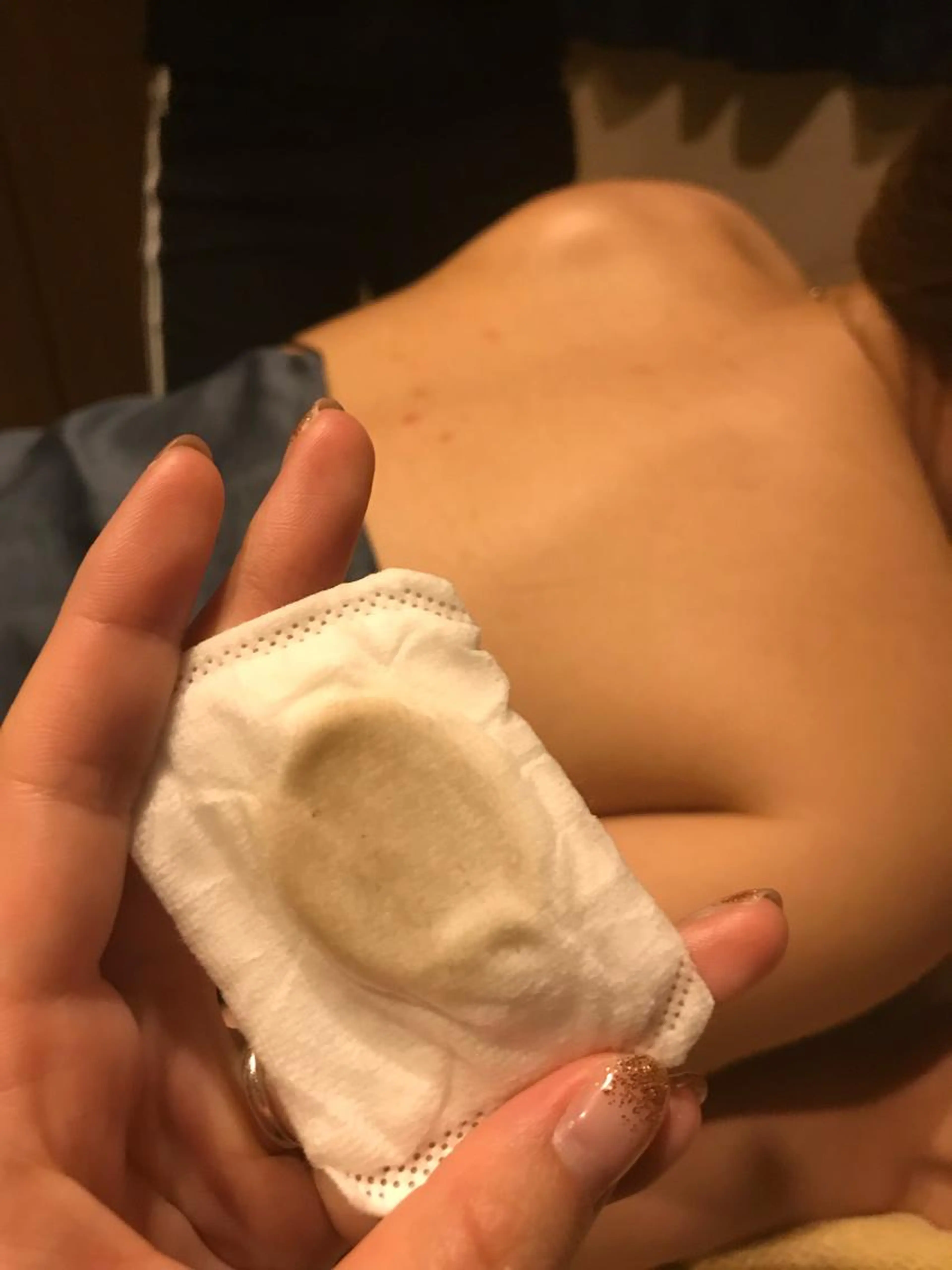 背中トラブル⚠️対策エステ〈ベッド〉の写真