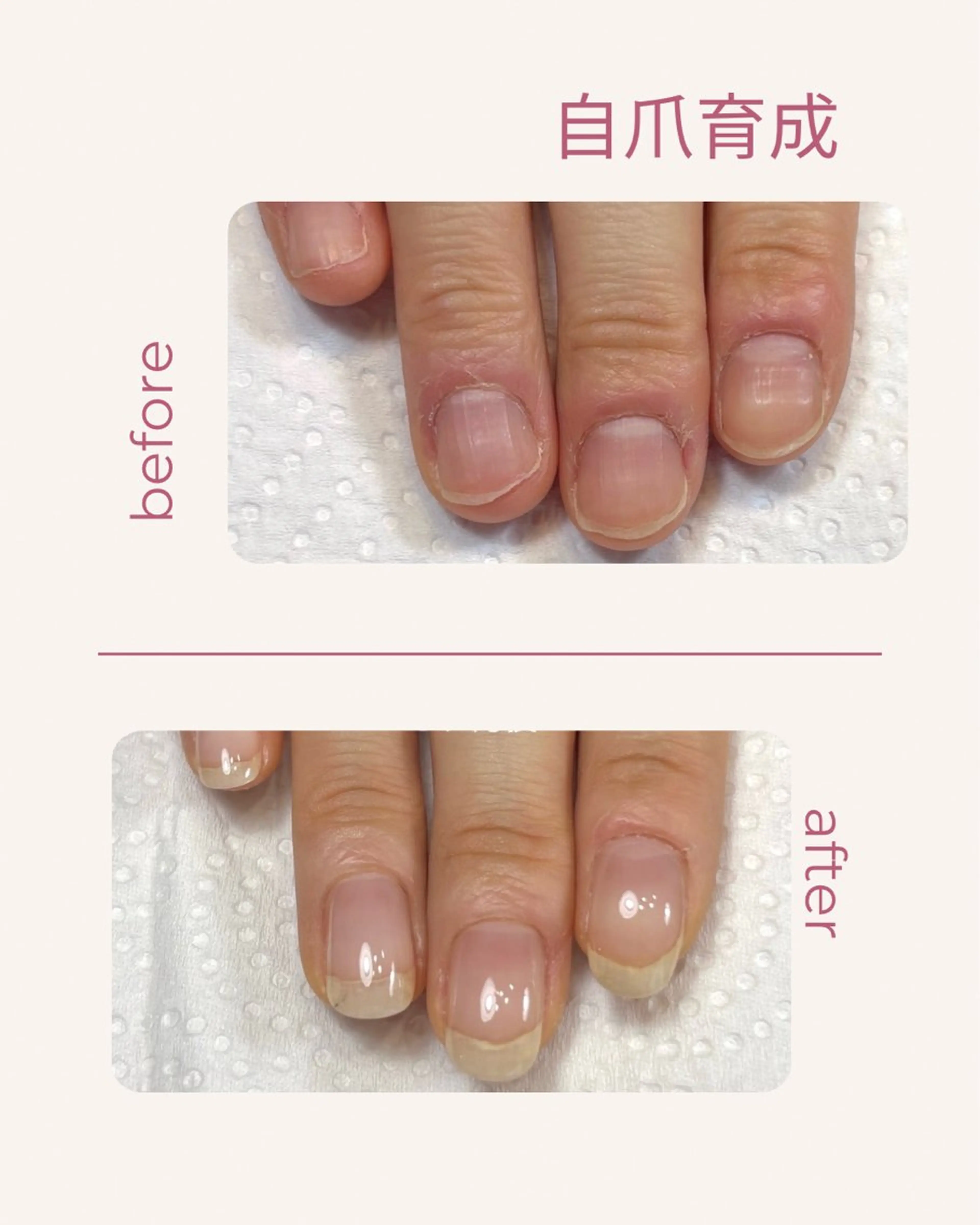 ネイル 自爪育成 Keshlyのネイルデザイン