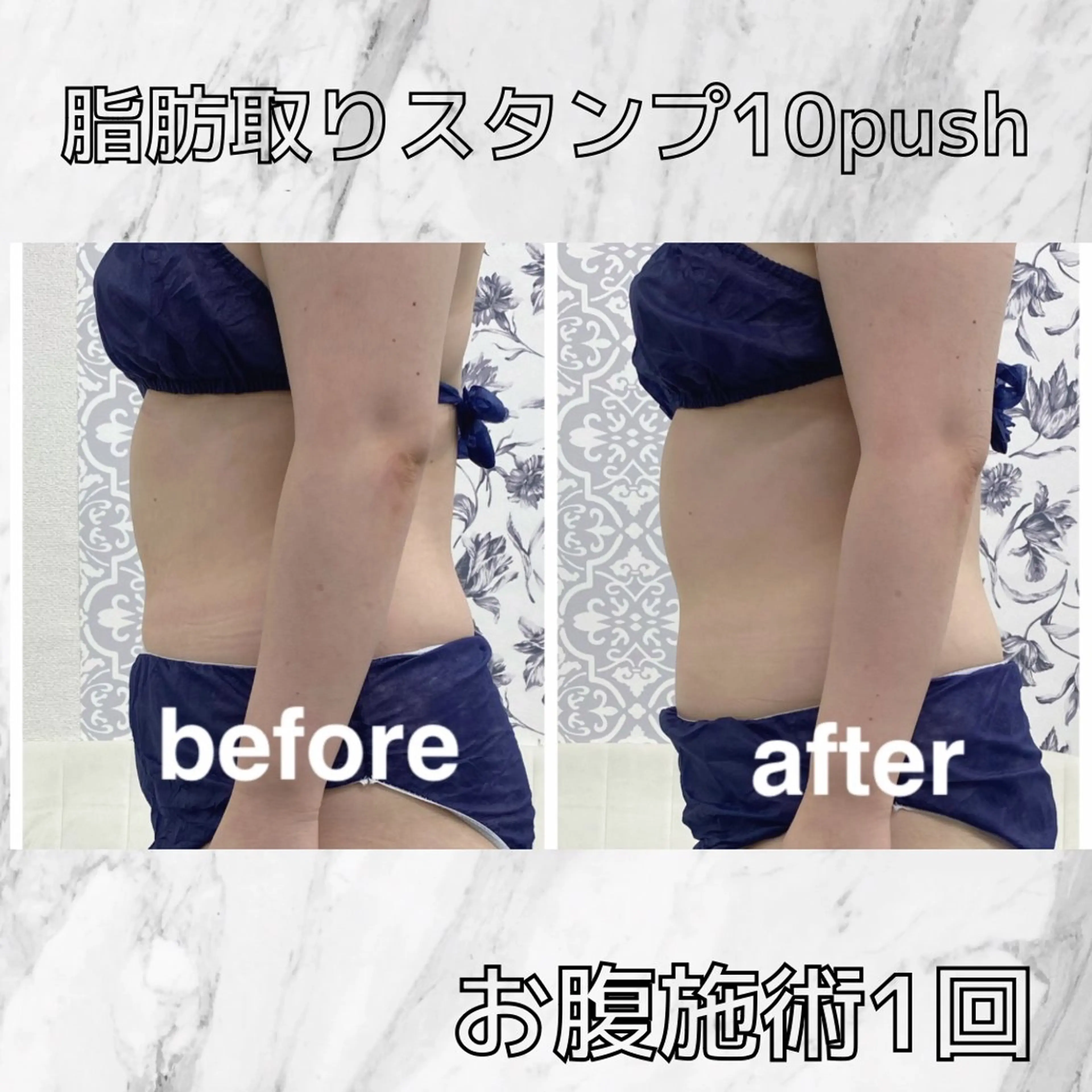 エステ 小顔痩身HALO 二宮早織のエステ・リラクイメージ