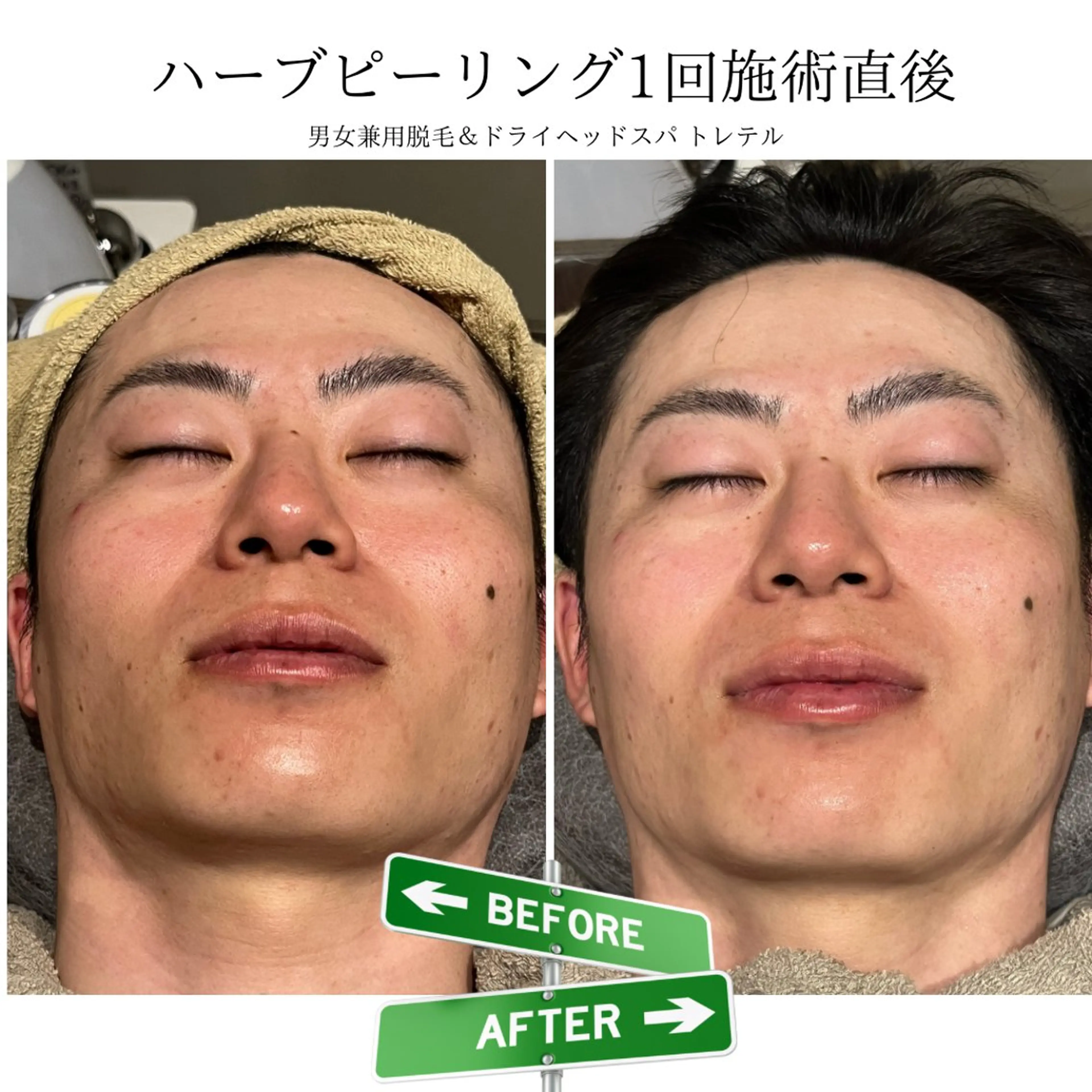 メンズ 男女兼用脱毛&ドライ ヘッドスパ トレテルのエステ・リラクイメージ