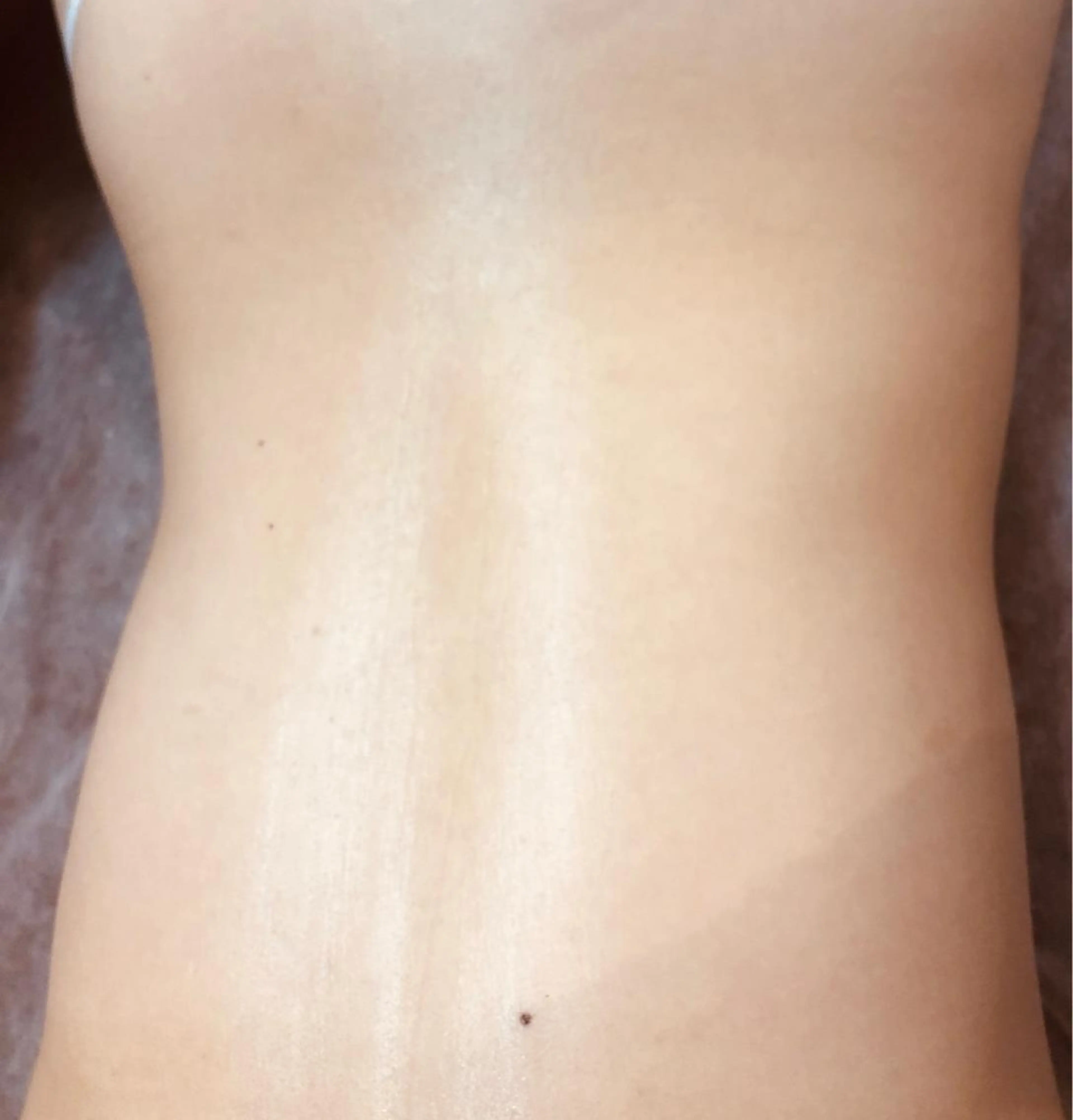 全身美肌脱毛　ベーシックプラン（VIOか顔のどちらか）見えないところも綺麗に素敵女子へ✨✨2回目以降の写真