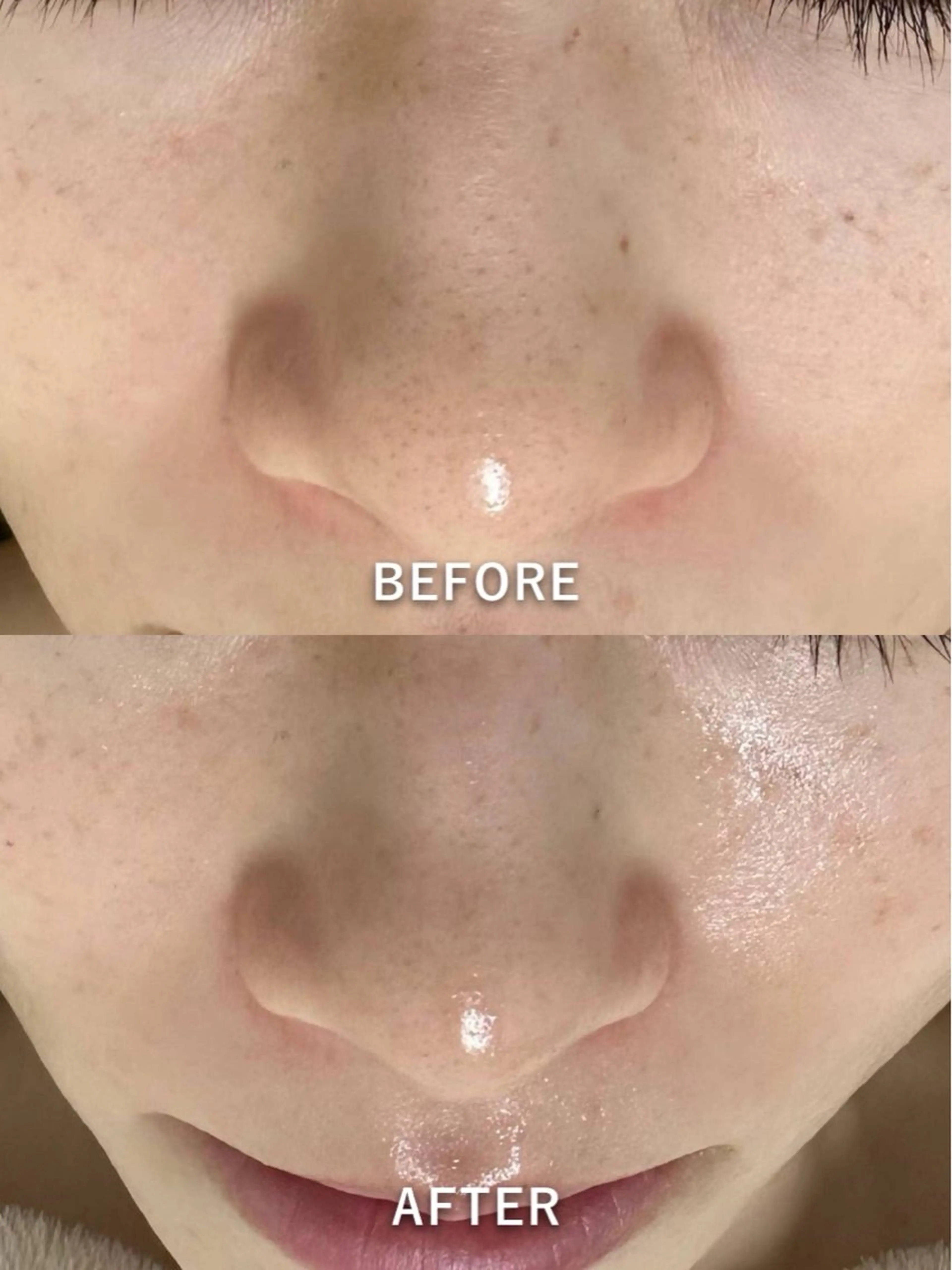 エステ 韓国美肌/肌質改善 【天神】yuiのエステ・リラクイメージ