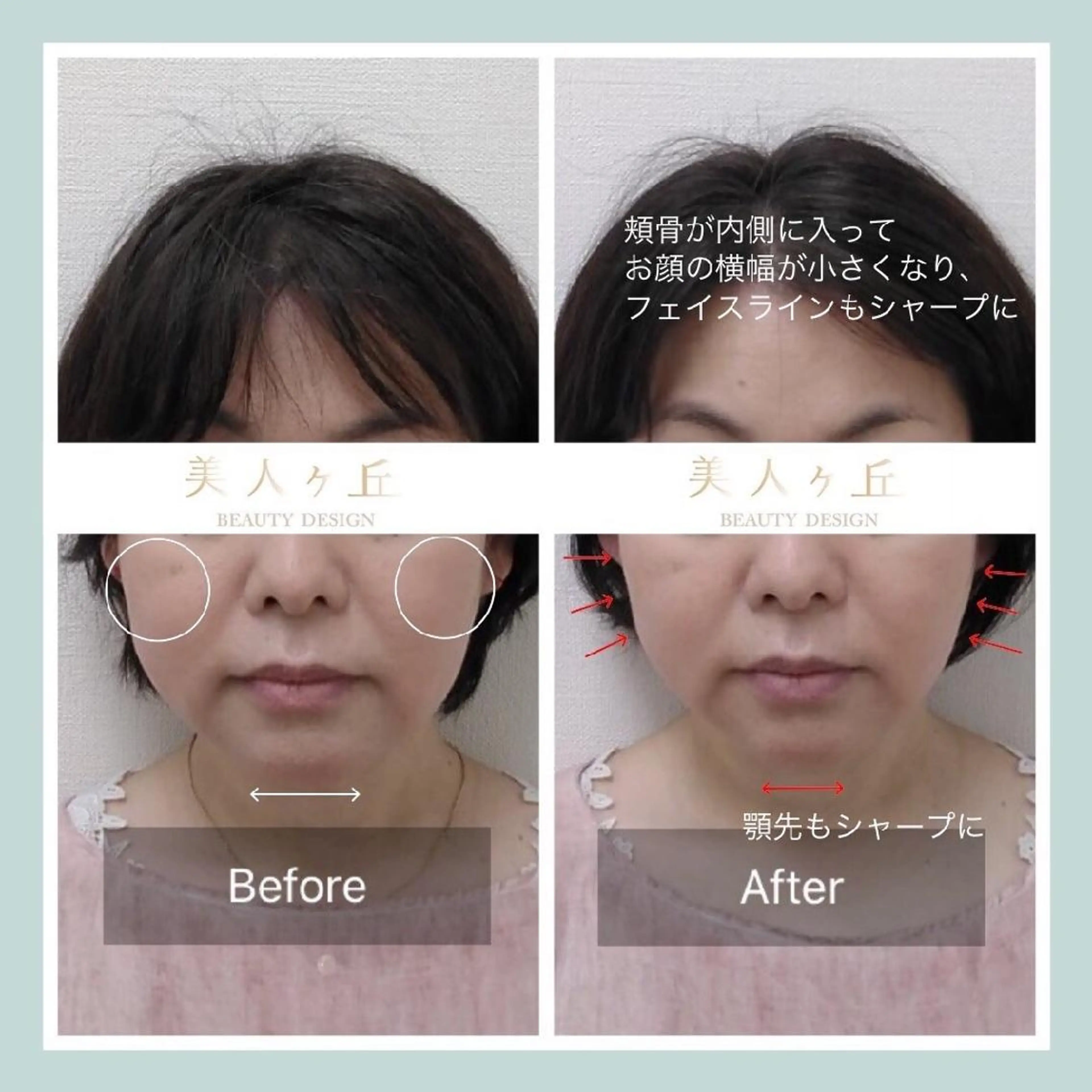 韓国/ヌーディー系 ネイル自由が丘のネイルデザイン