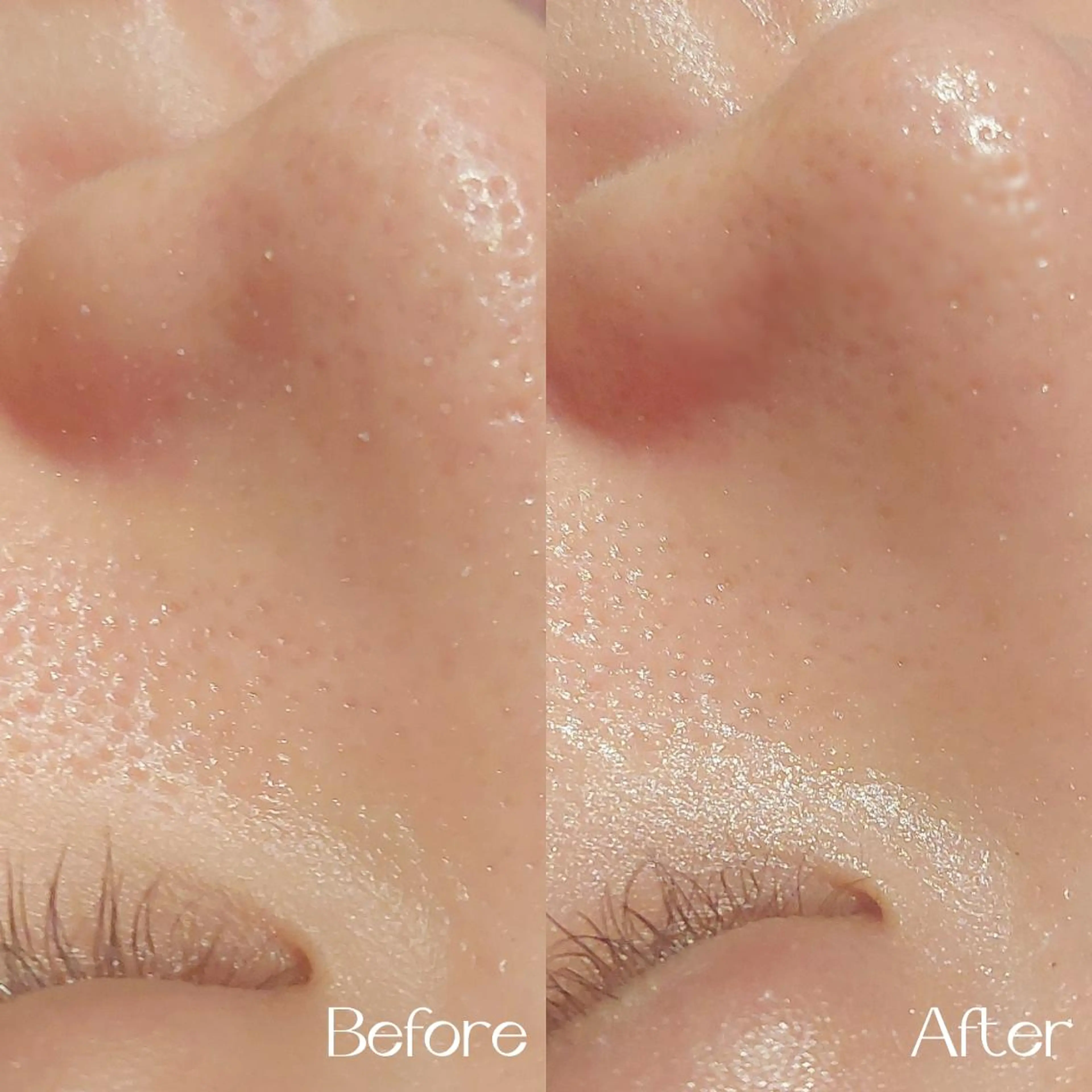 エステ MyFairLady miuのエステ・リラクイメージ