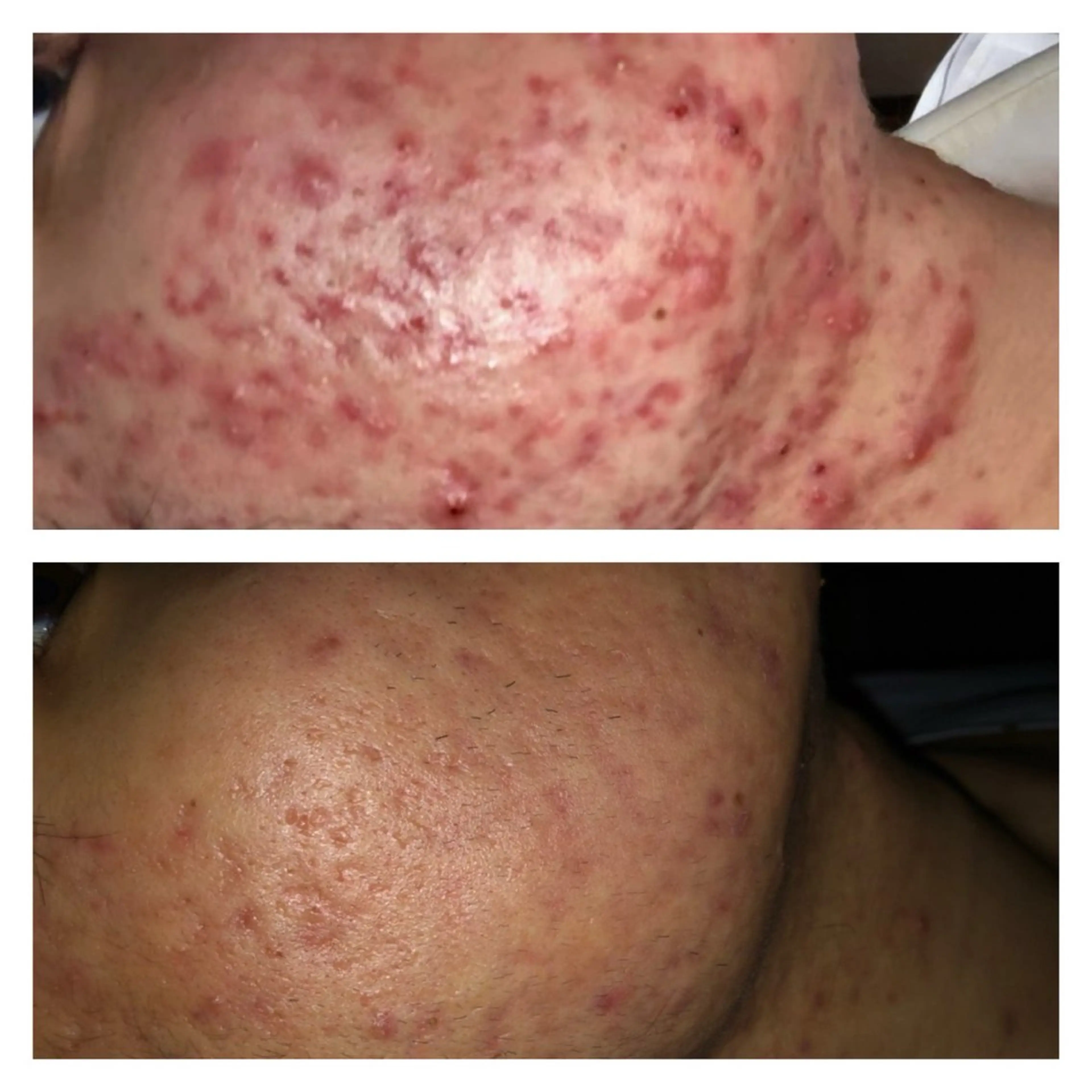 Lussera(ルセラ)所属・肌質を変えて すっぴん肌に✨のその他イメージ