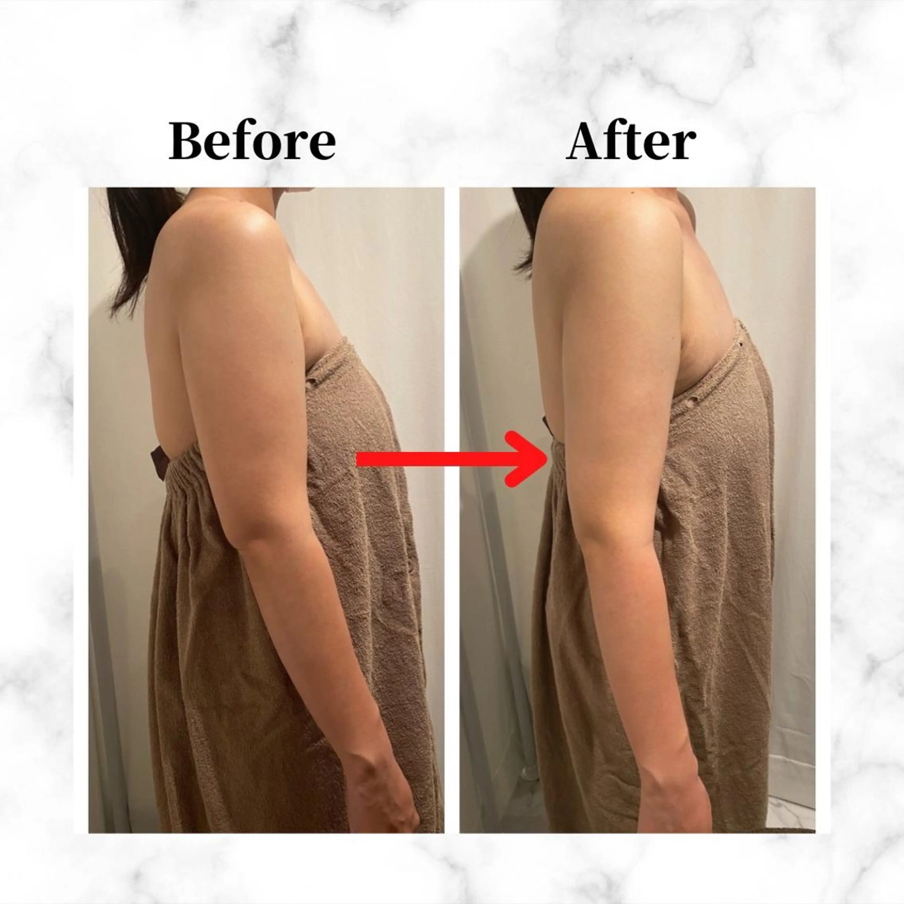 エステ リラク 12Dハイフ💗 最強小顔のエステ・リラクイメージ