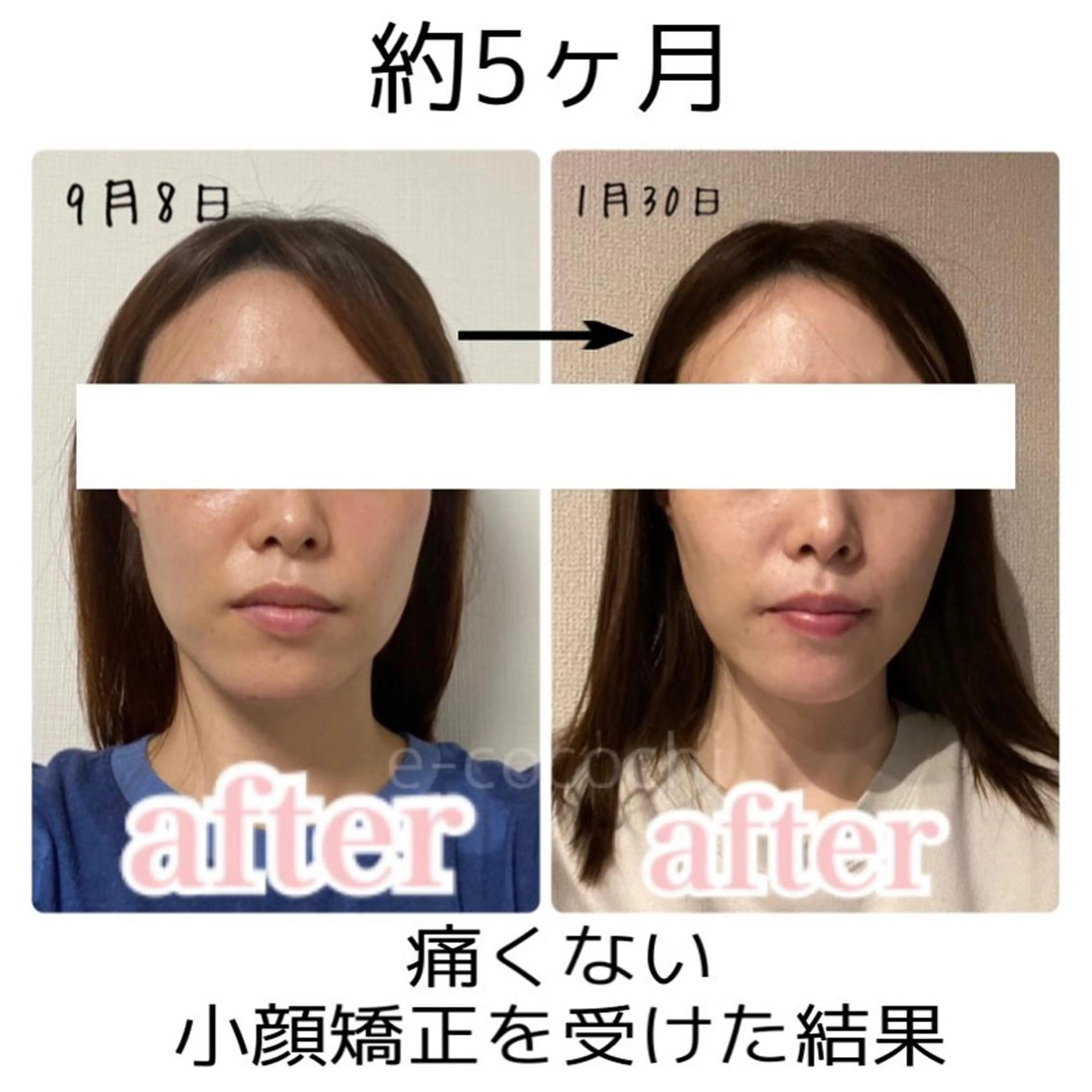 エステ 小顔と ヘッドスパのお店のエステ・リラクイメージ