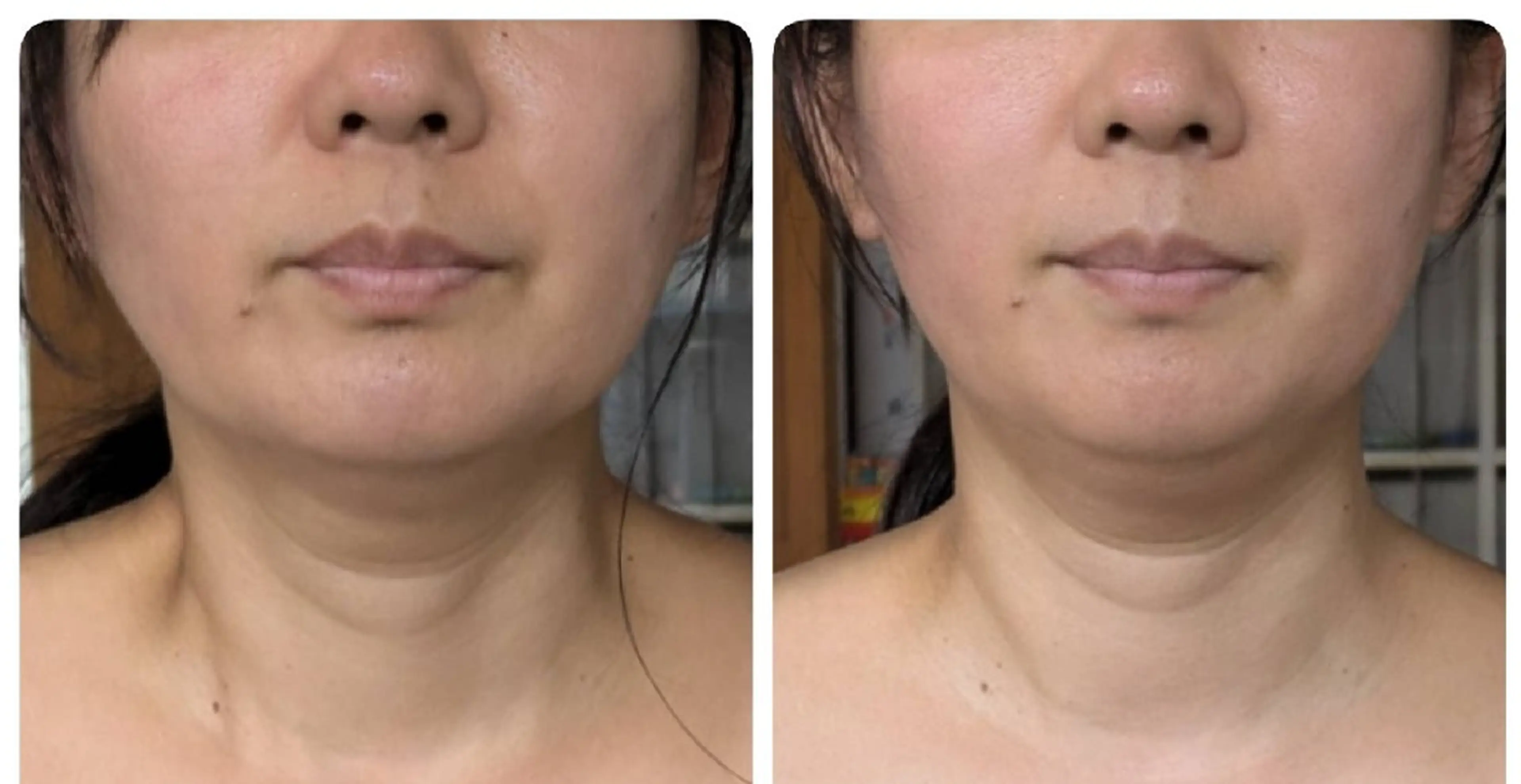 リラク はなえみの森所属・上戸 千瑞のエステ・リラクイメージ