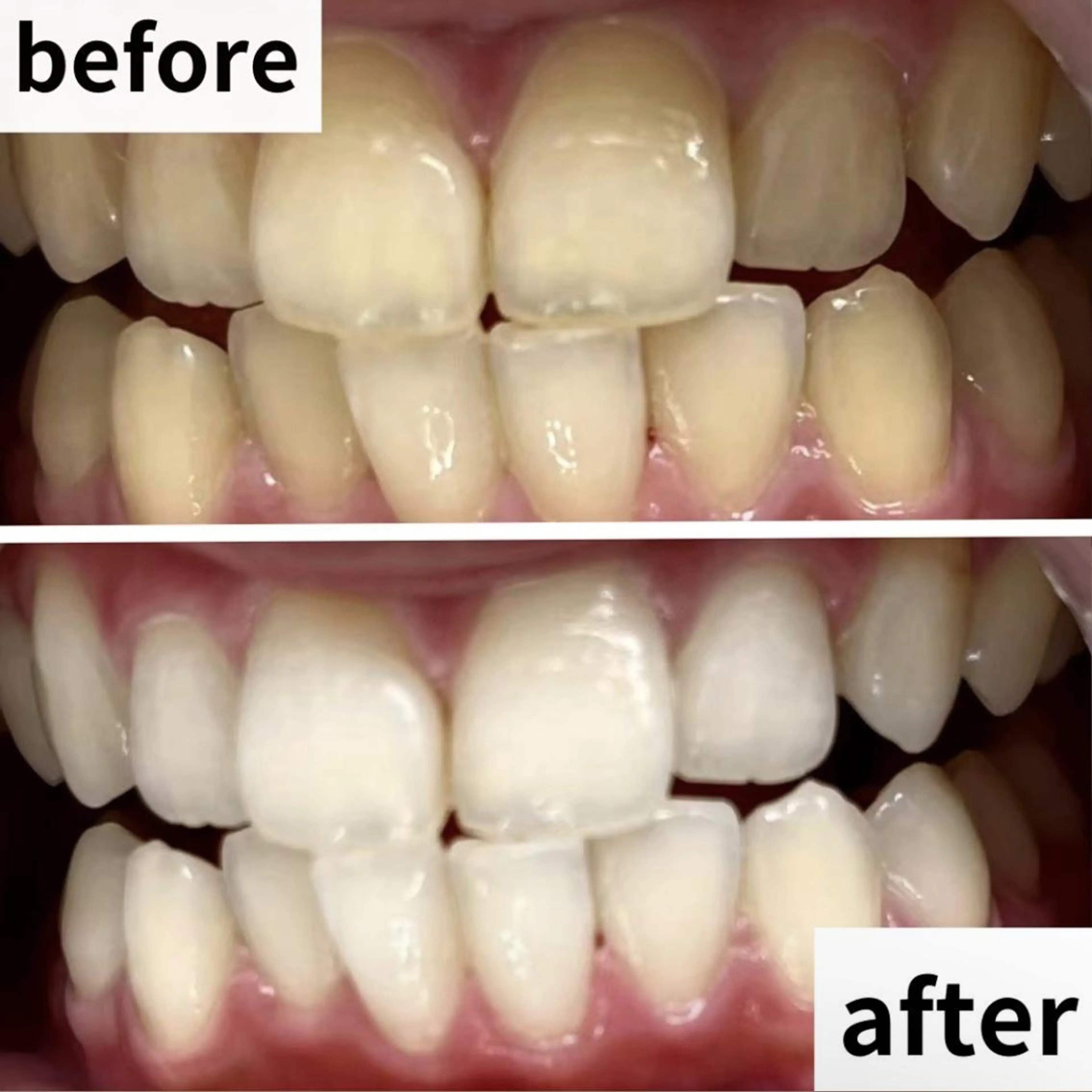 LBSホワイトニング 🌐渋谷店 小河原のエステ・リラクイメージ