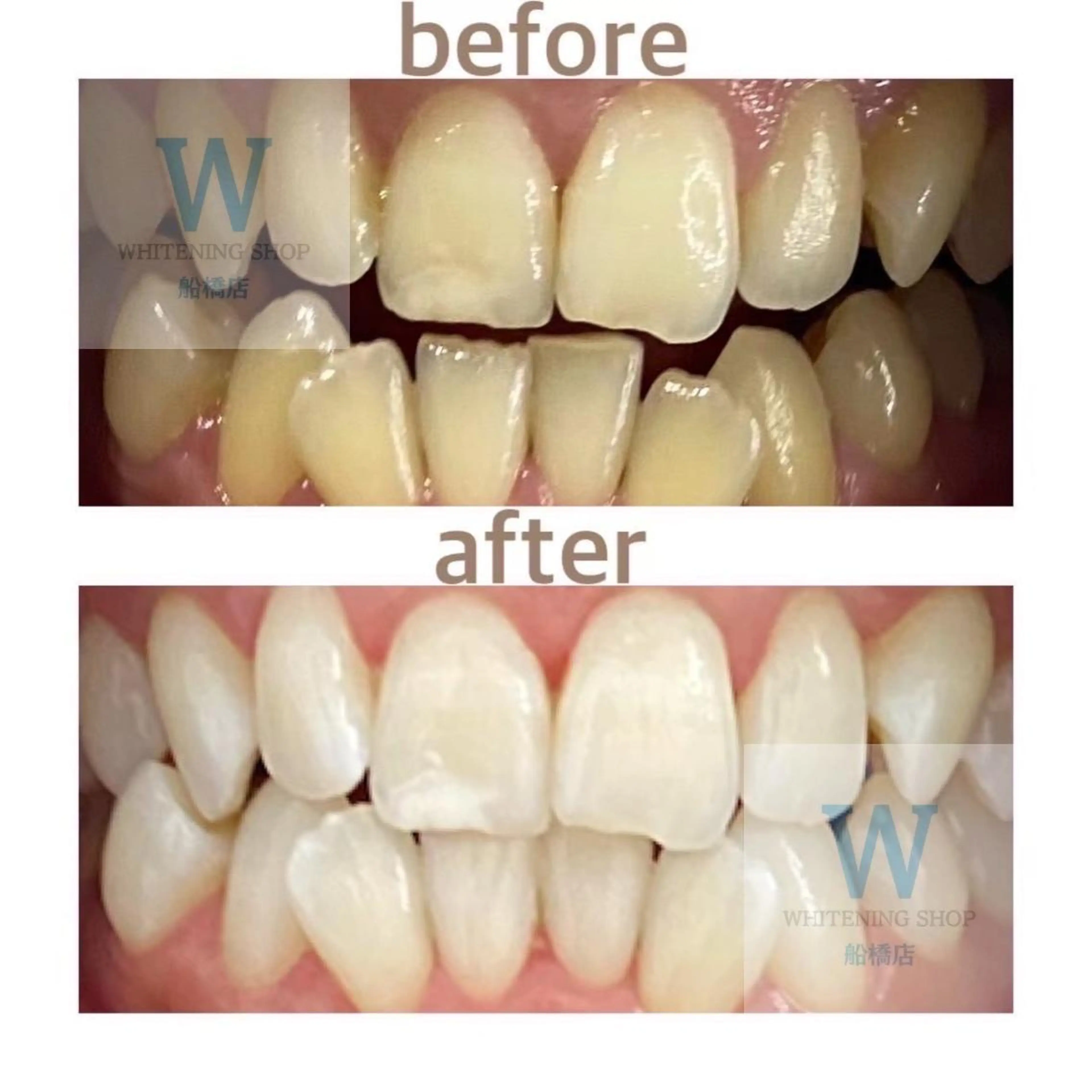 ホワイトニング ショップ船橋店🦷のエステ・リラクイメージ