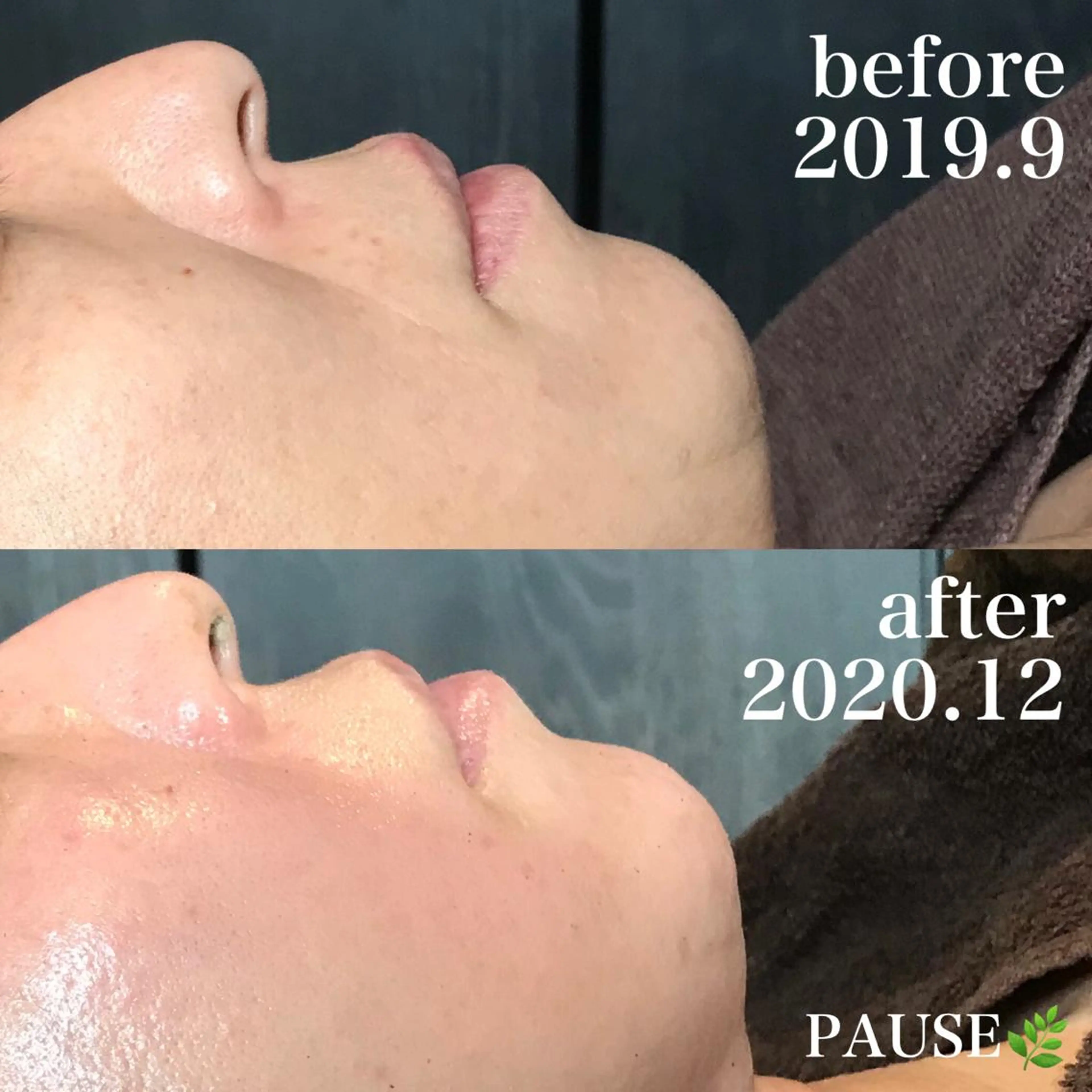 エステ 浜野 恵美のエステ・リラクイメージ