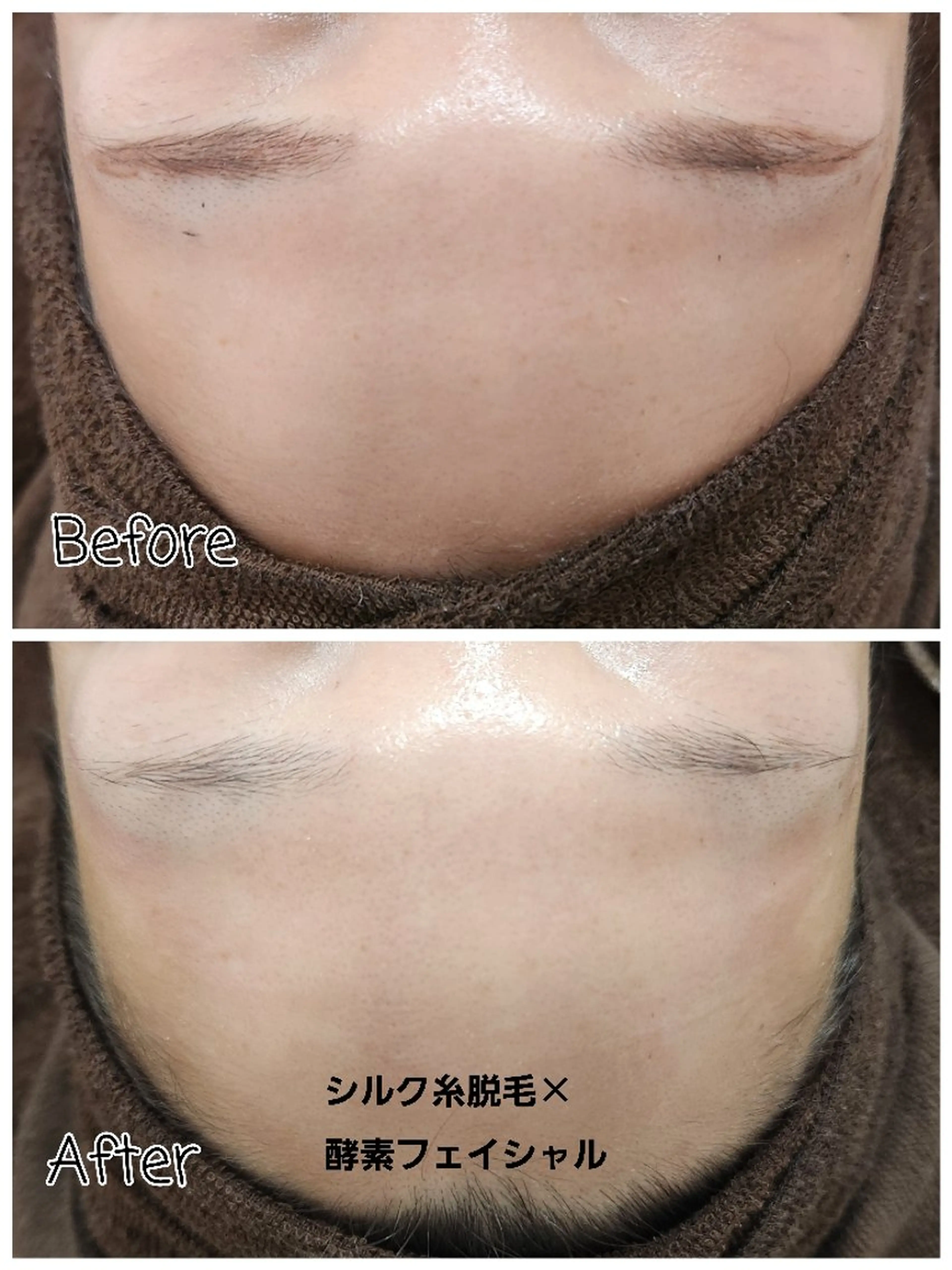 Perte所属・ . Atsumiのエステ・リラクイメージ