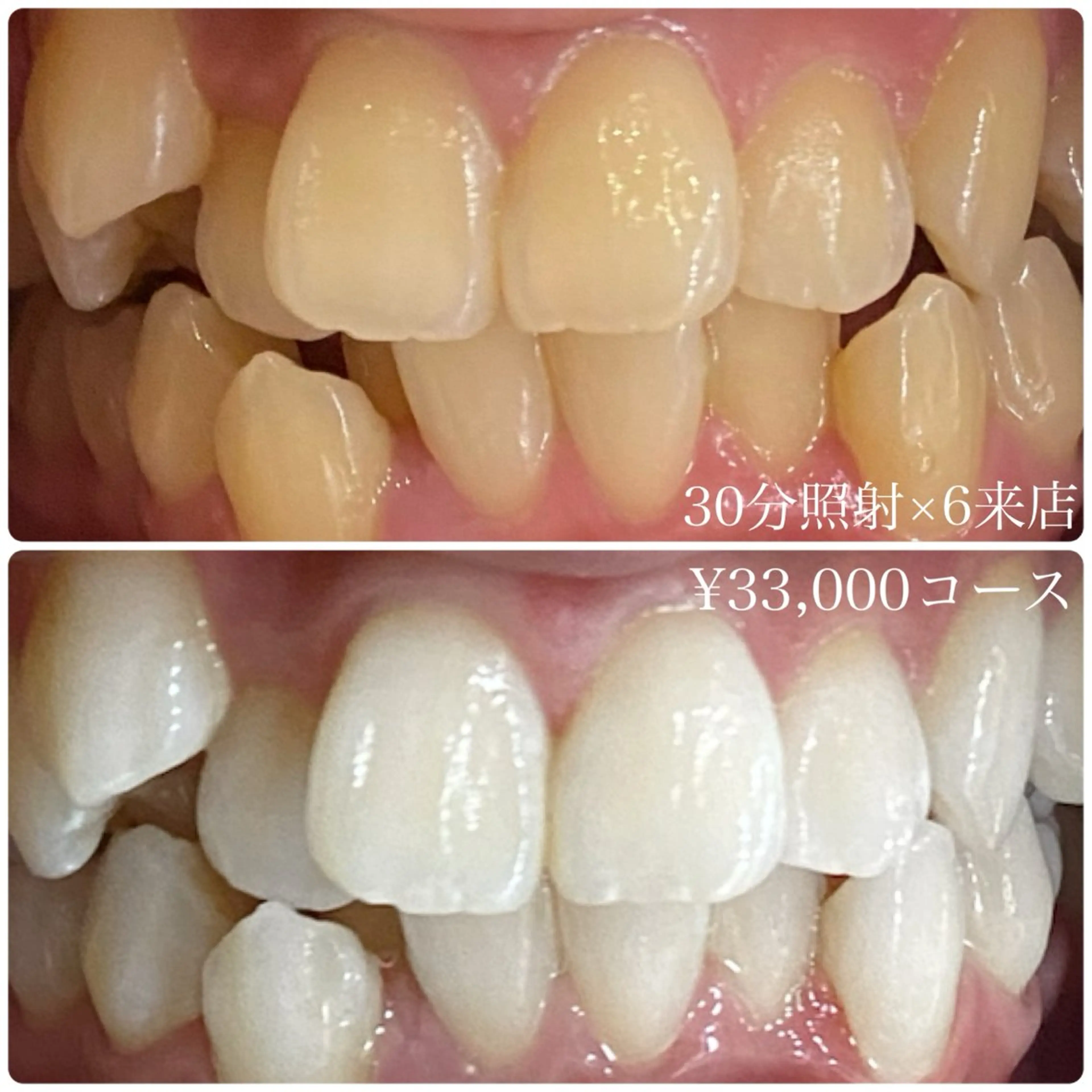 メンズ その他 ホワイトニングルーム　川崎店所属・ホワイトニング ルーム　川崎店のその他イメージ