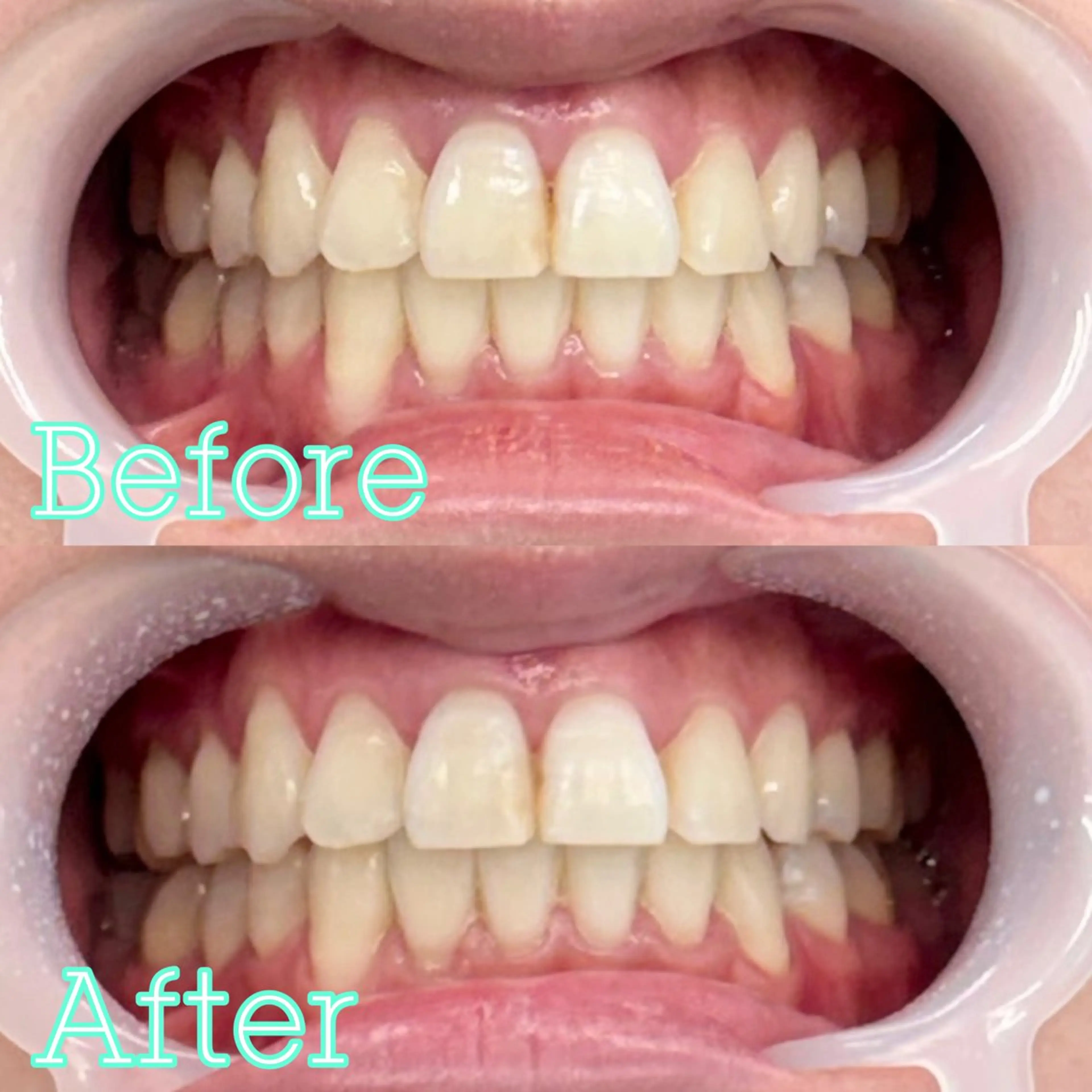 歯のホワイトニング専門店 MIGAQ 京都四条大宮店所属・佐藤 未来の眉毛・アイブロウイメージ