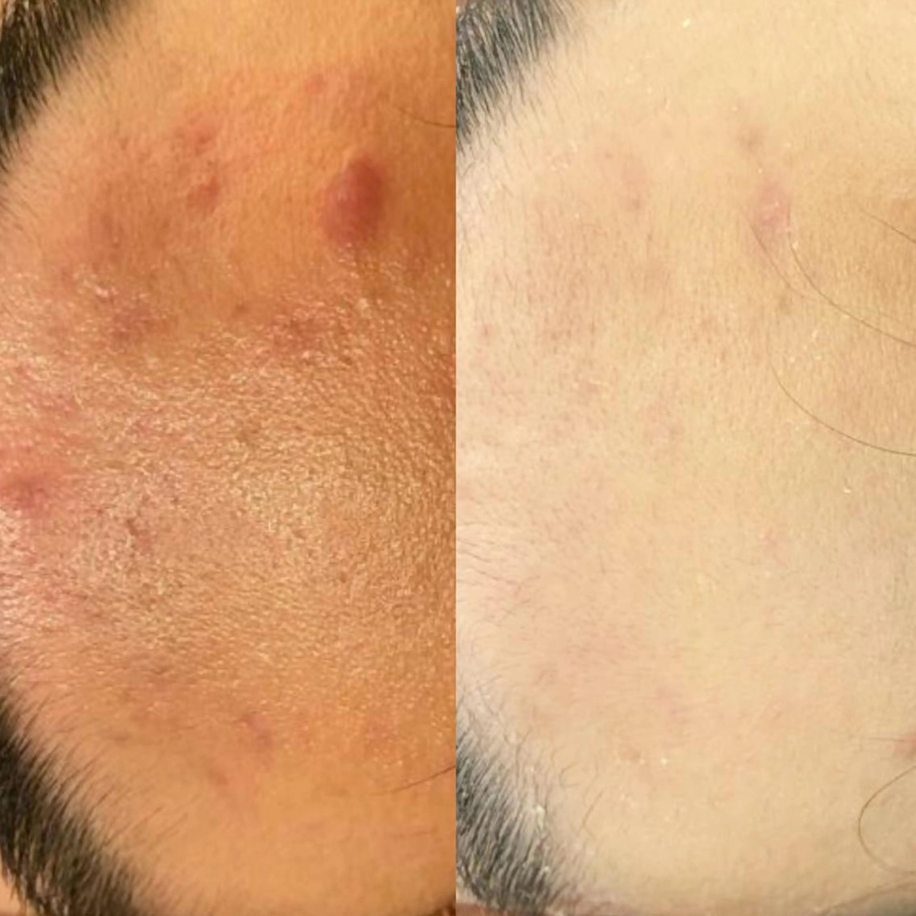 ニキビ経験者が施術 する専門サロン🌻のエステ・リラクイメージ