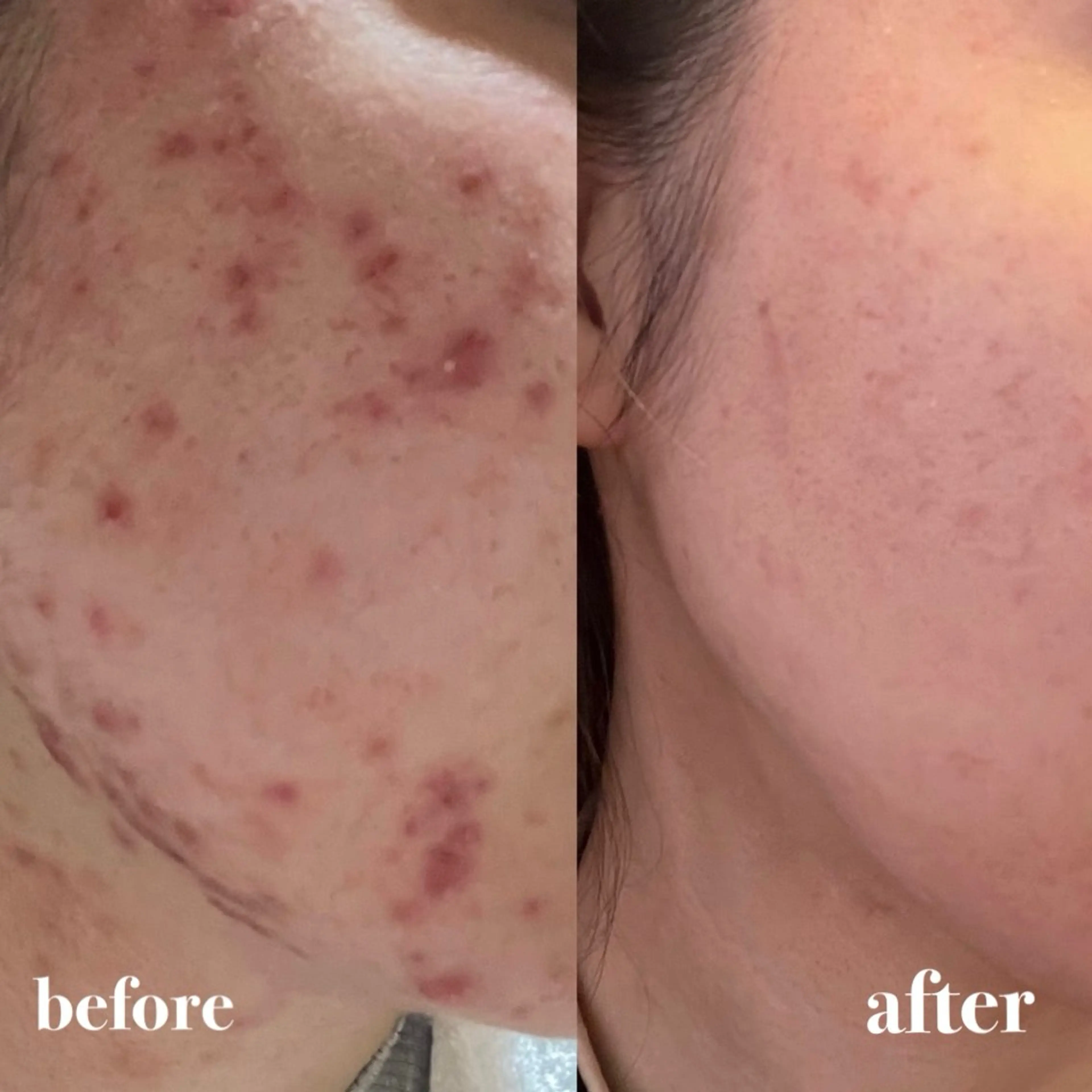 NAZ  (ナーズ)のエステ・リラクイメージ