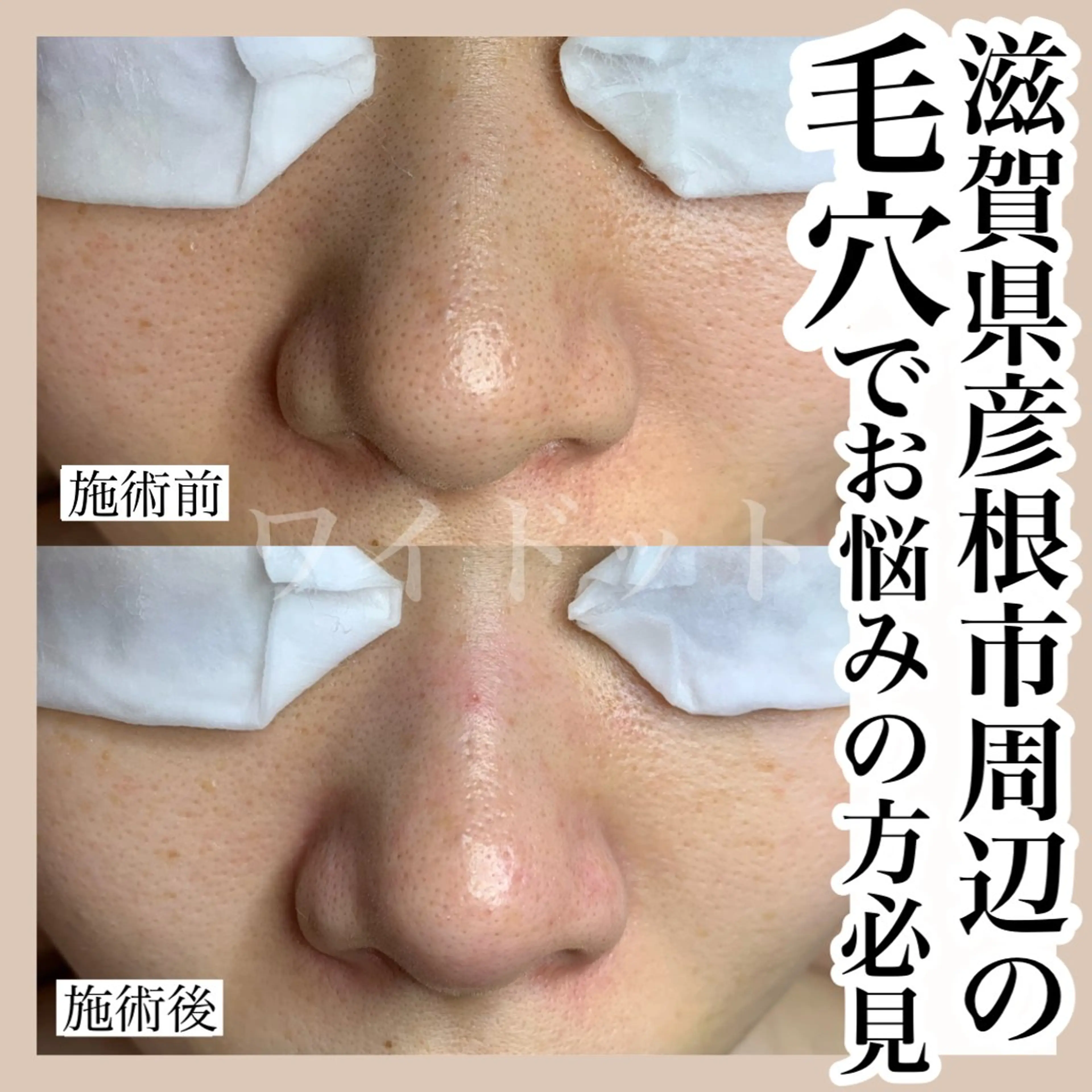 エステ Ydot. 池内 友架のエステ・リラクイメージ