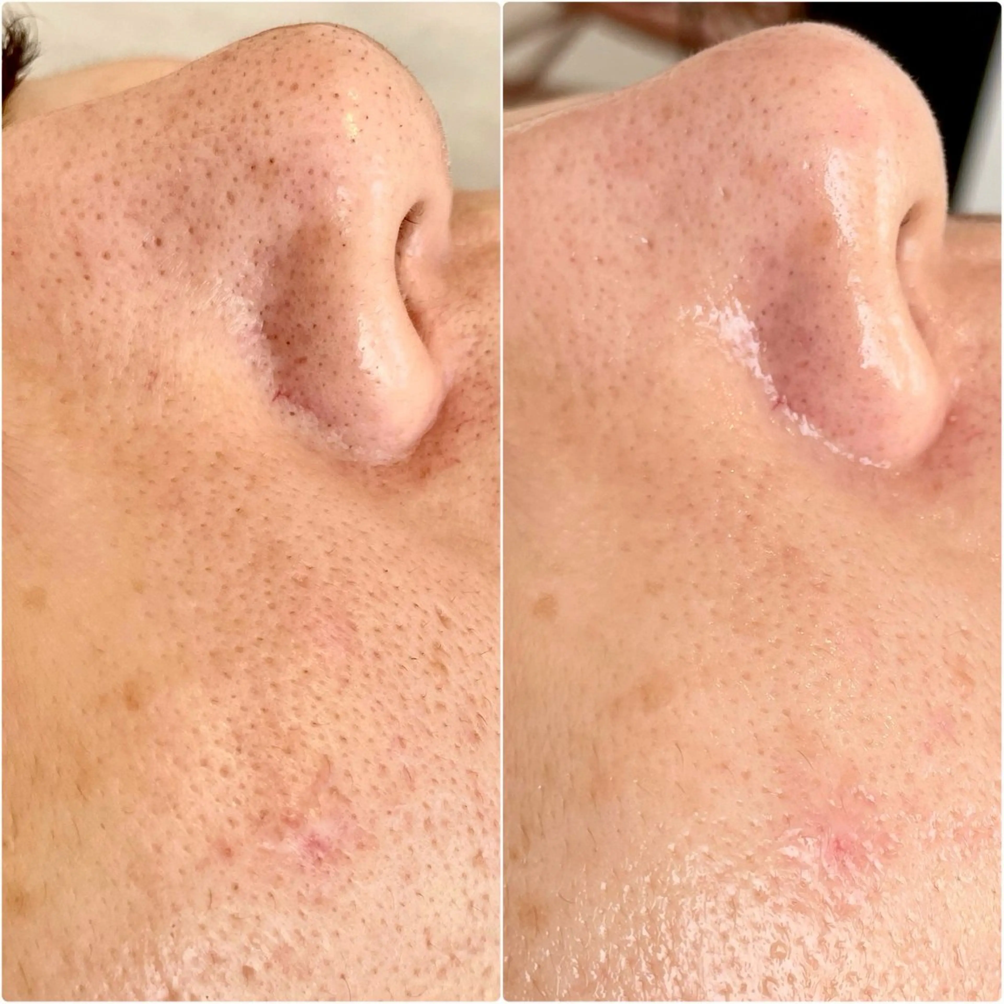 エステ リラク íam所属・íam natsukiのエステ・リラクイメージ