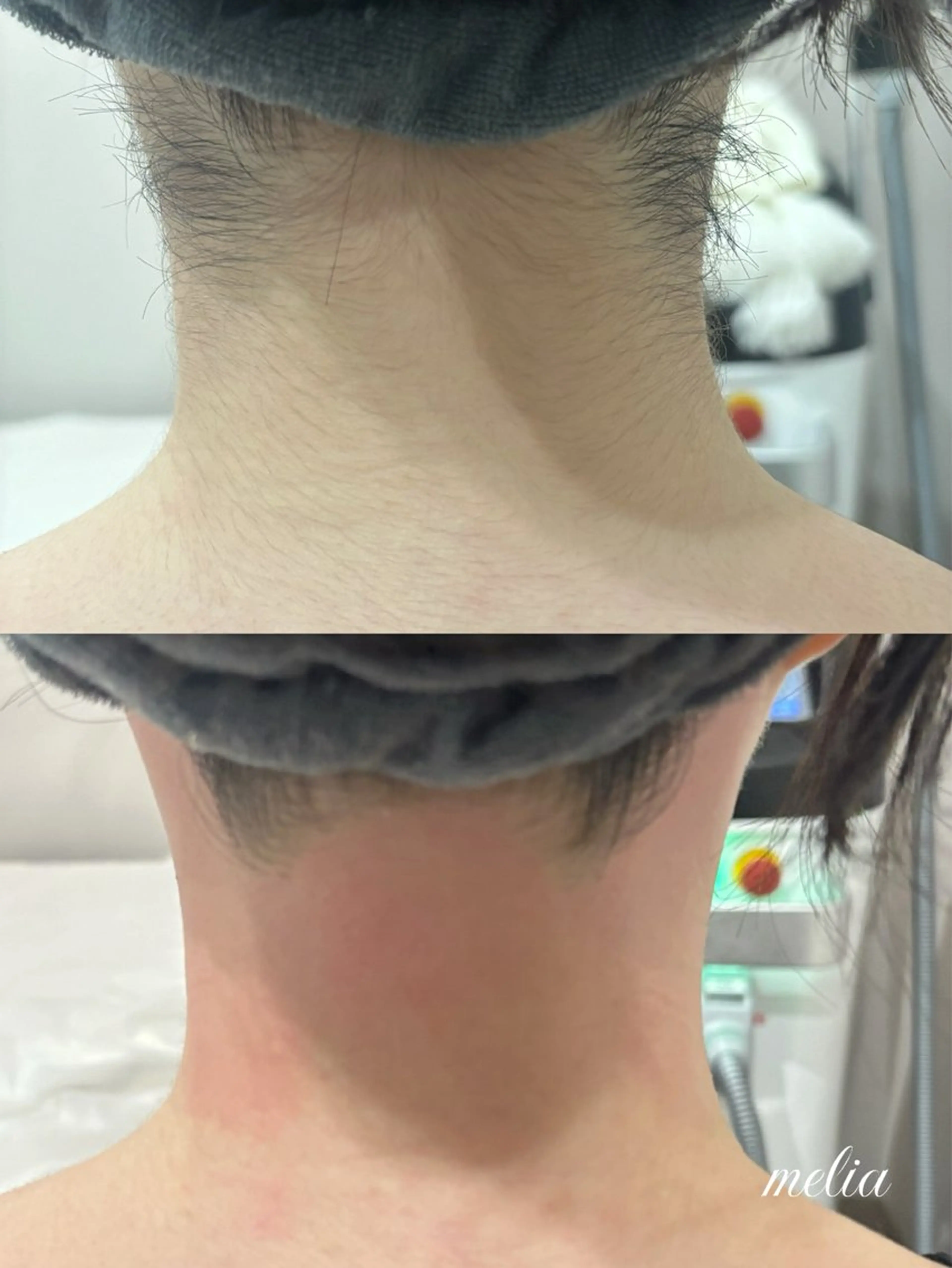 脱毛 melia 岡山駅前店のエステ・リラクイメージ