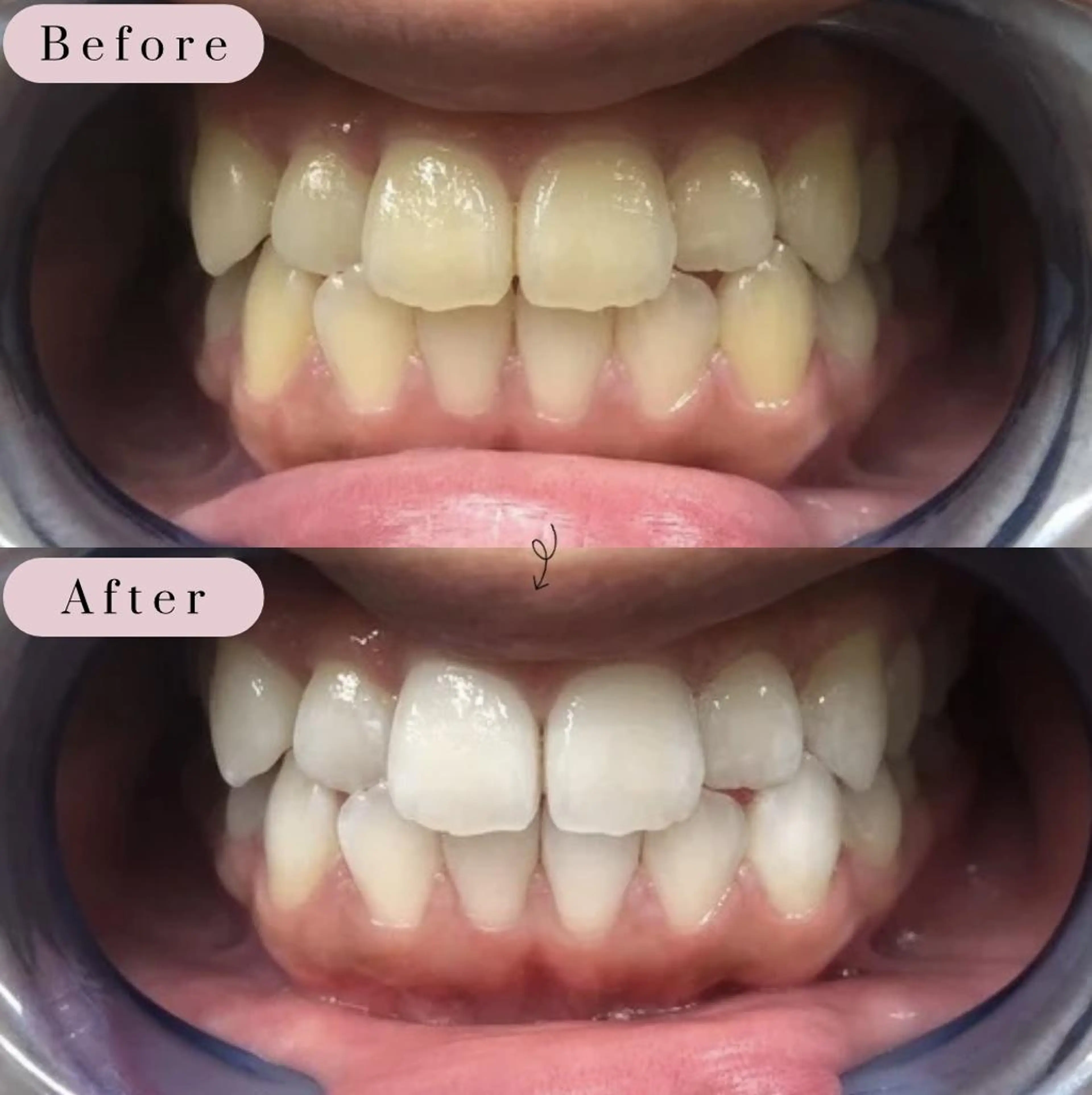 ホワイトニングサロン rize　花岡のその他イメージ