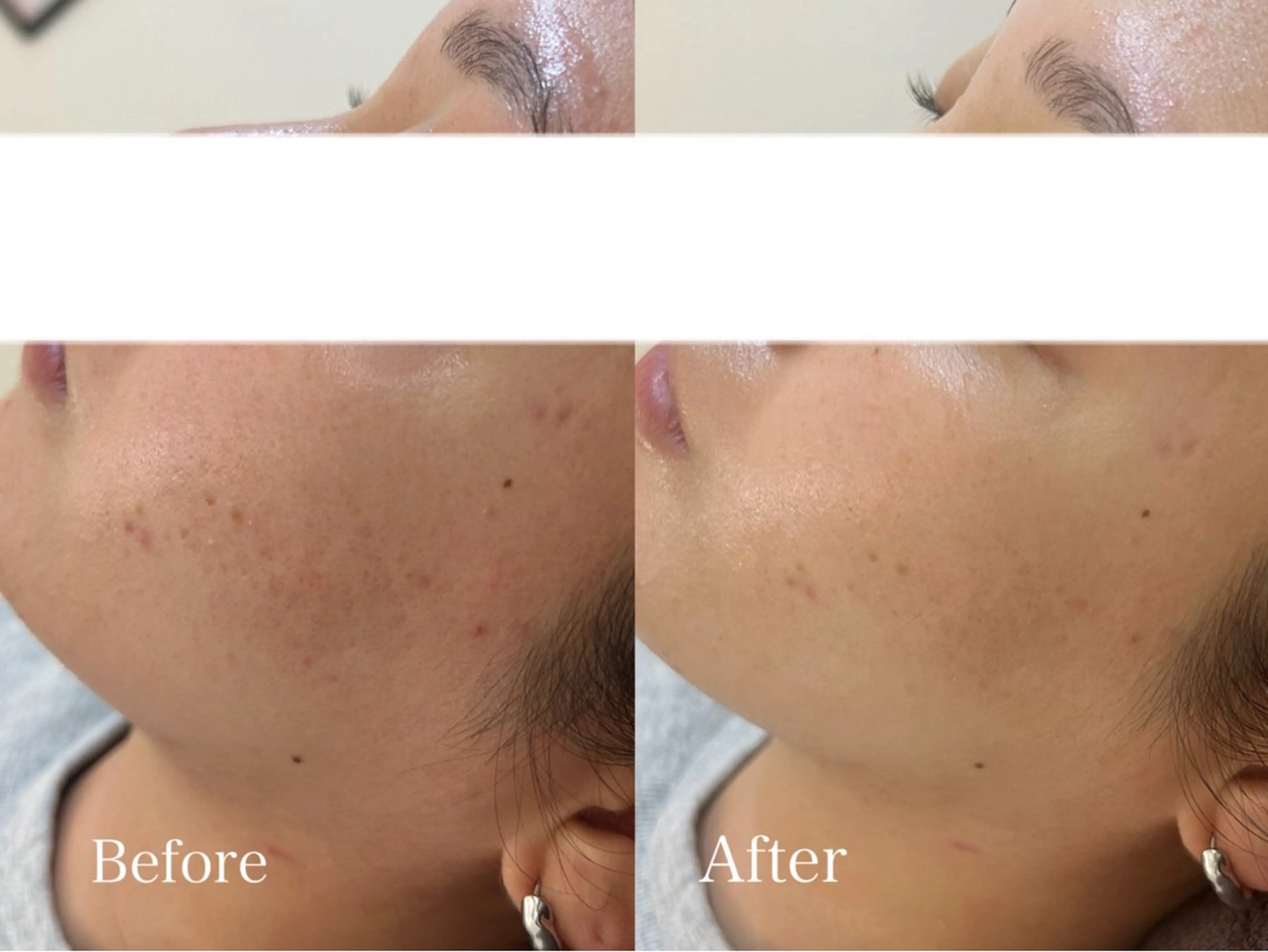 Belle beauty salon所属・Bellebeau tysalonのエステ・リラクイメージ