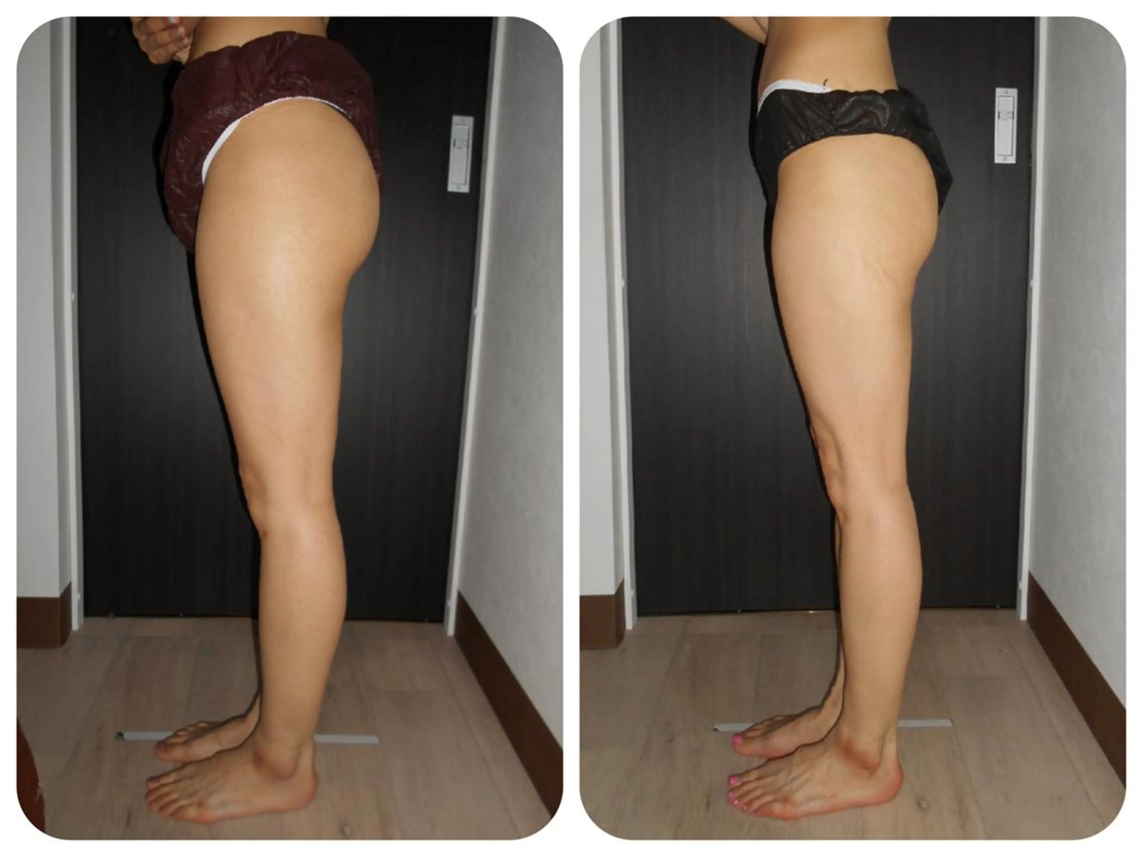 小顔専門店 グレイスボディ三郷店のエステ・リラクイメージ