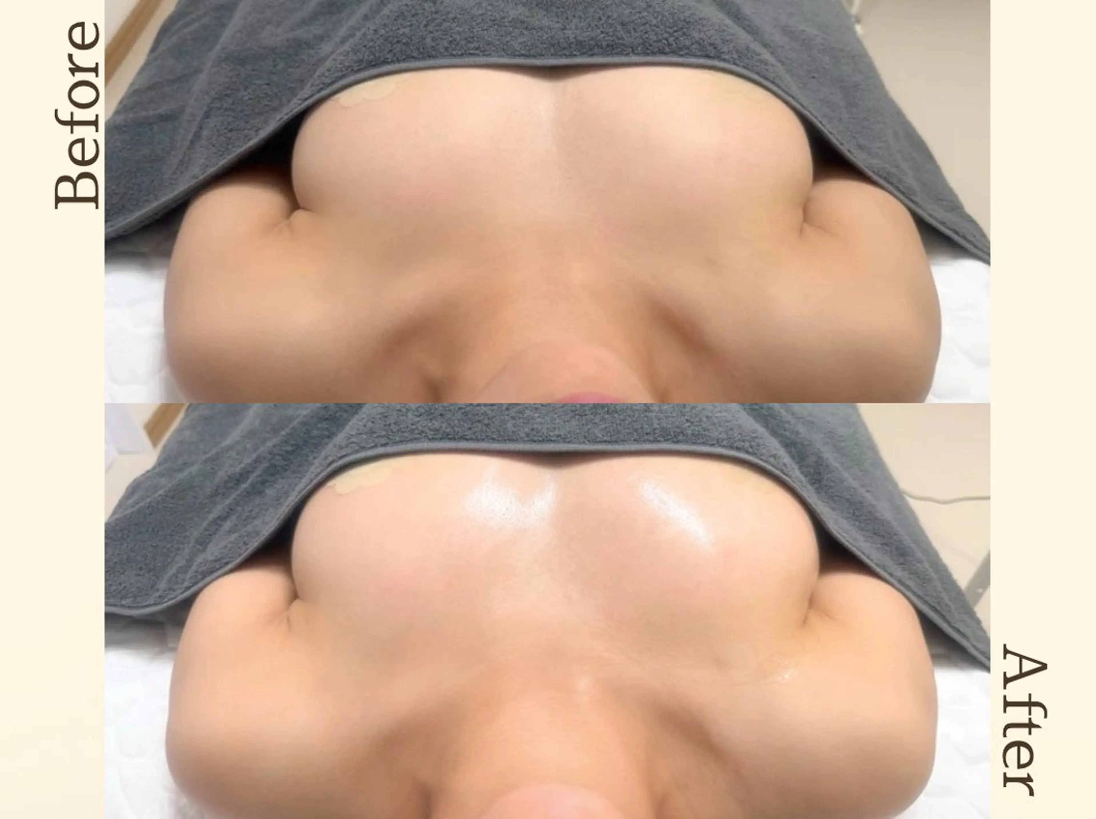 【まずは相談したい方へ】体の状態チェック付きバスト+肩こりケア体験の写真