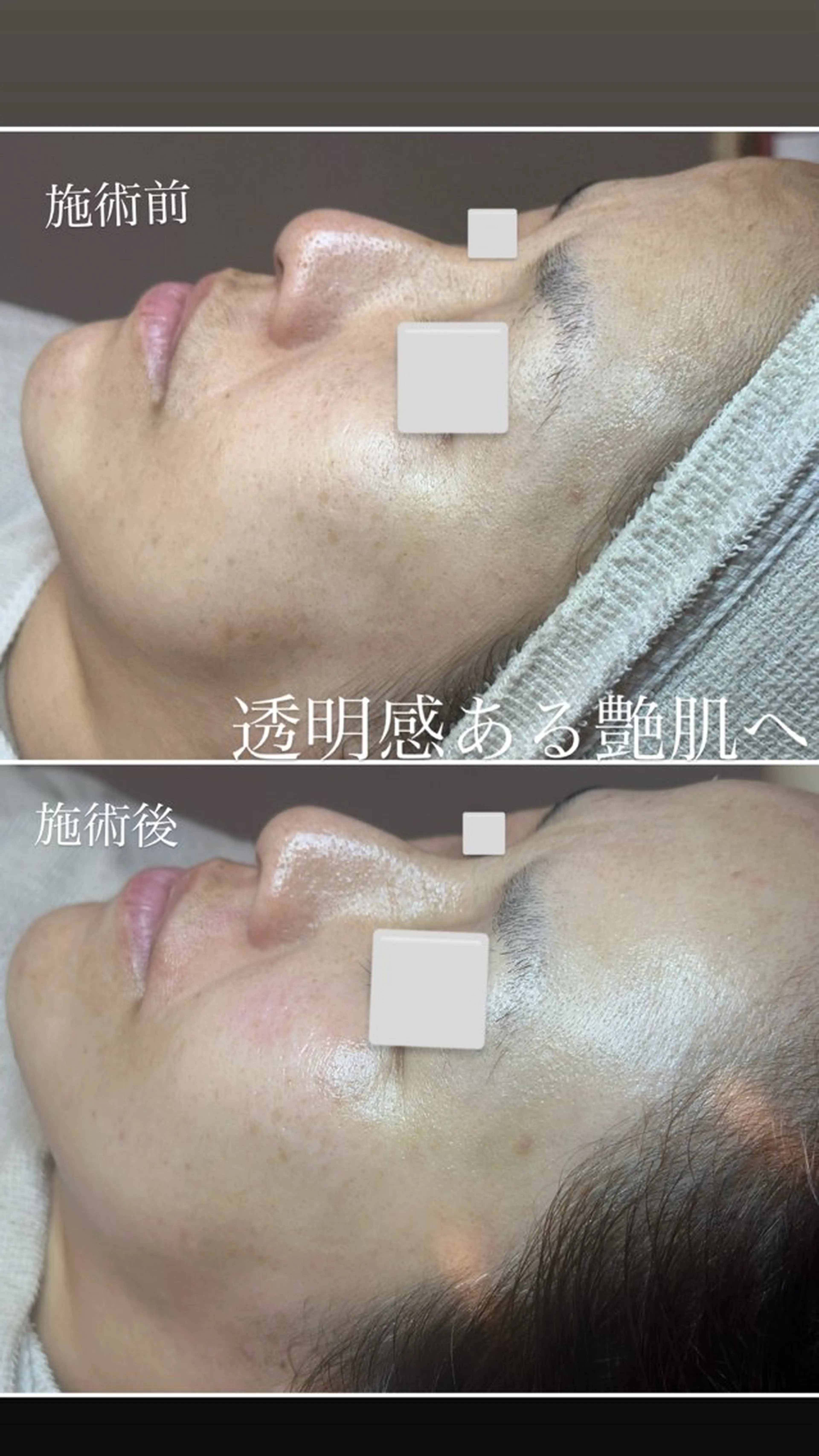 マツヤニWax専門/ 岸和田/Luanaのエステ・リラクイメージ