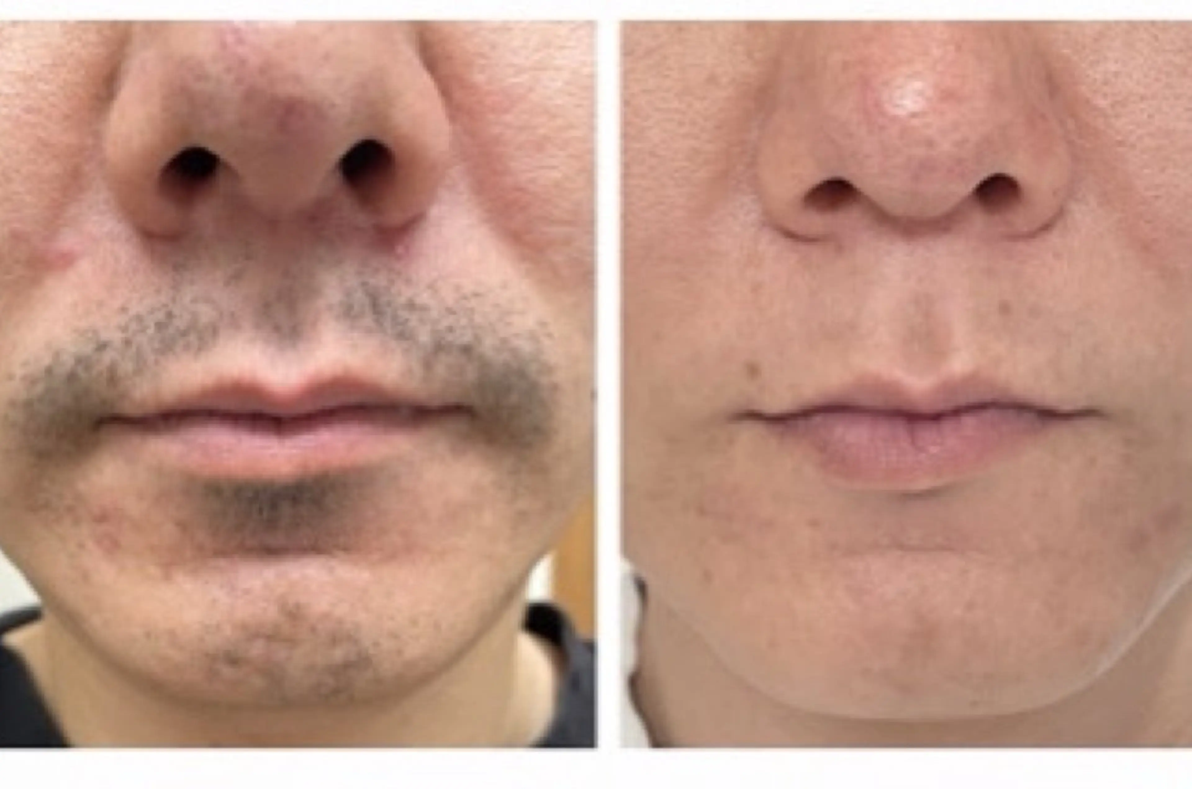 脱毛専門減毛サロン LULU.tokyoのエステ・リラクイメージ