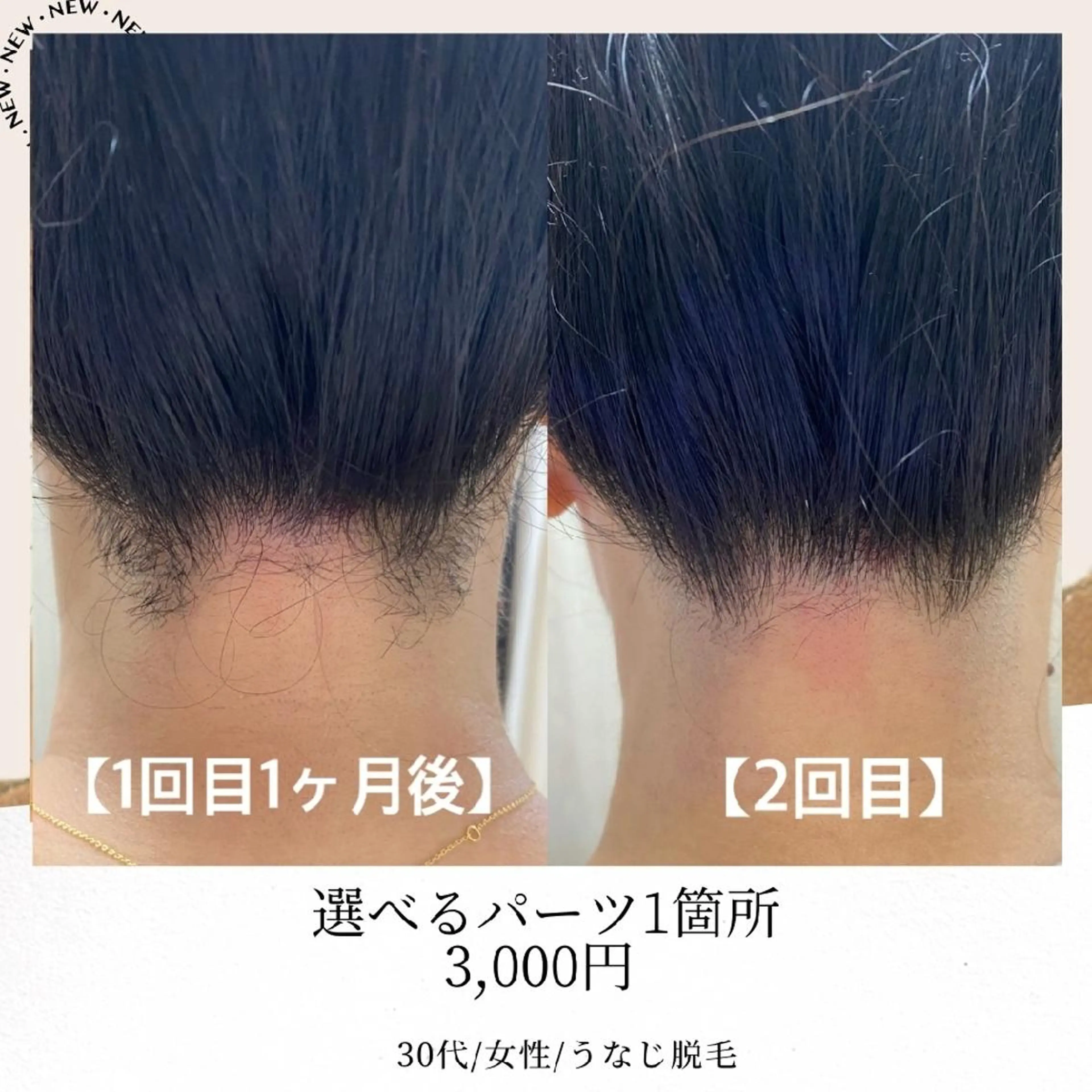 みんなの脱毛 TSURURINの眉毛・アイブロウイメージ