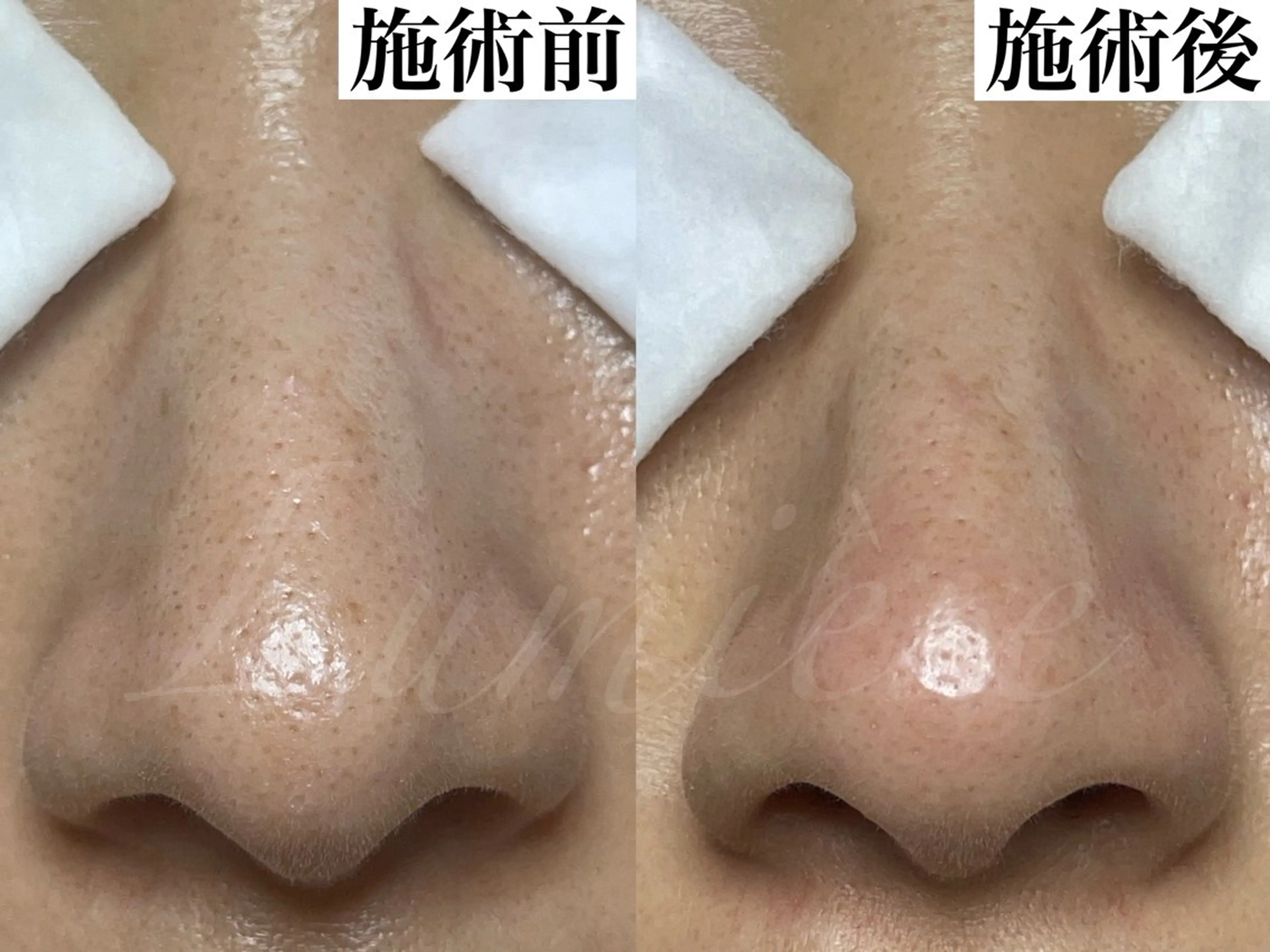 マツヤニワックス専門 堂山町 ルミエールのエステ・リラクイメージ