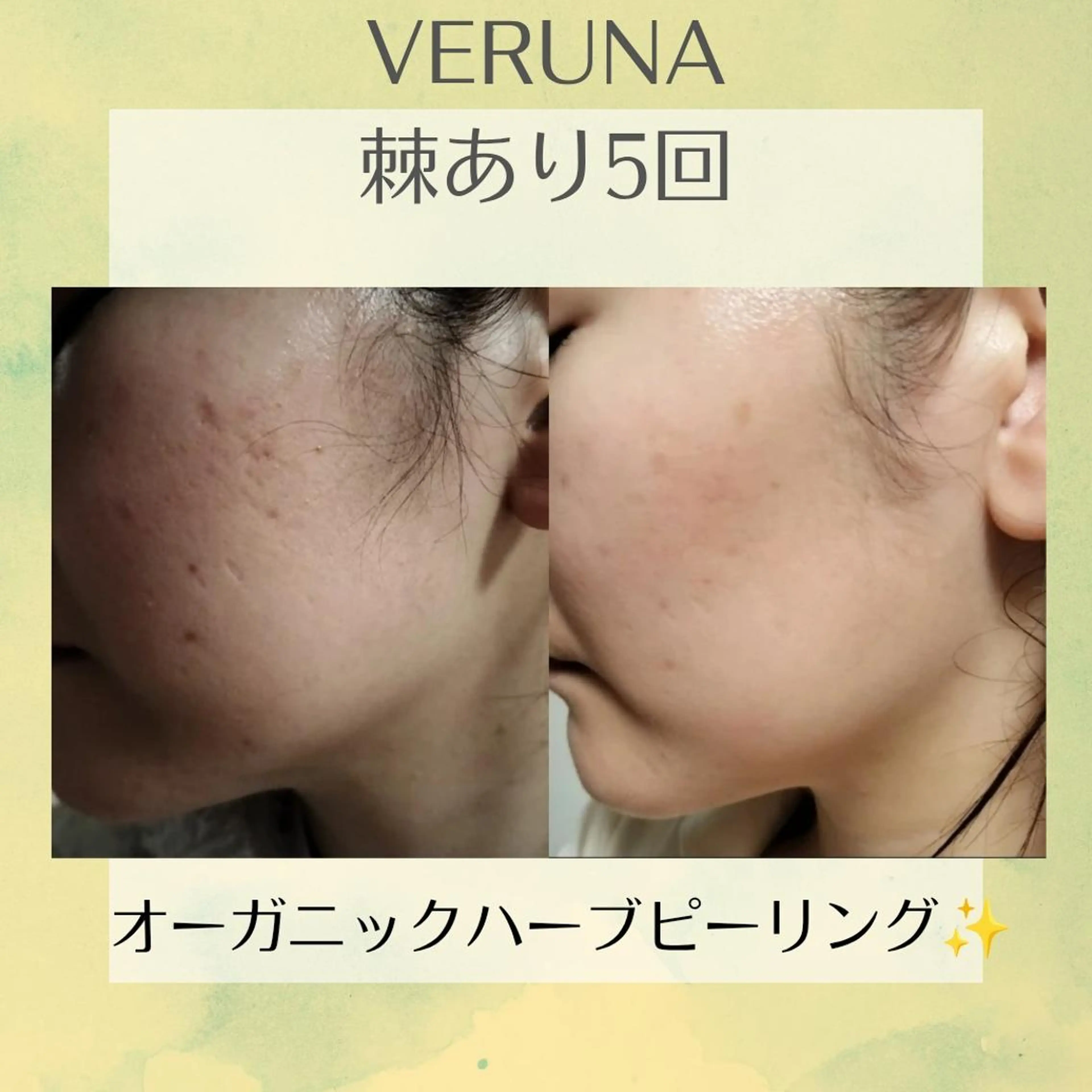 プライベートサロン リレア･ラカのエステ・リラクイメージ