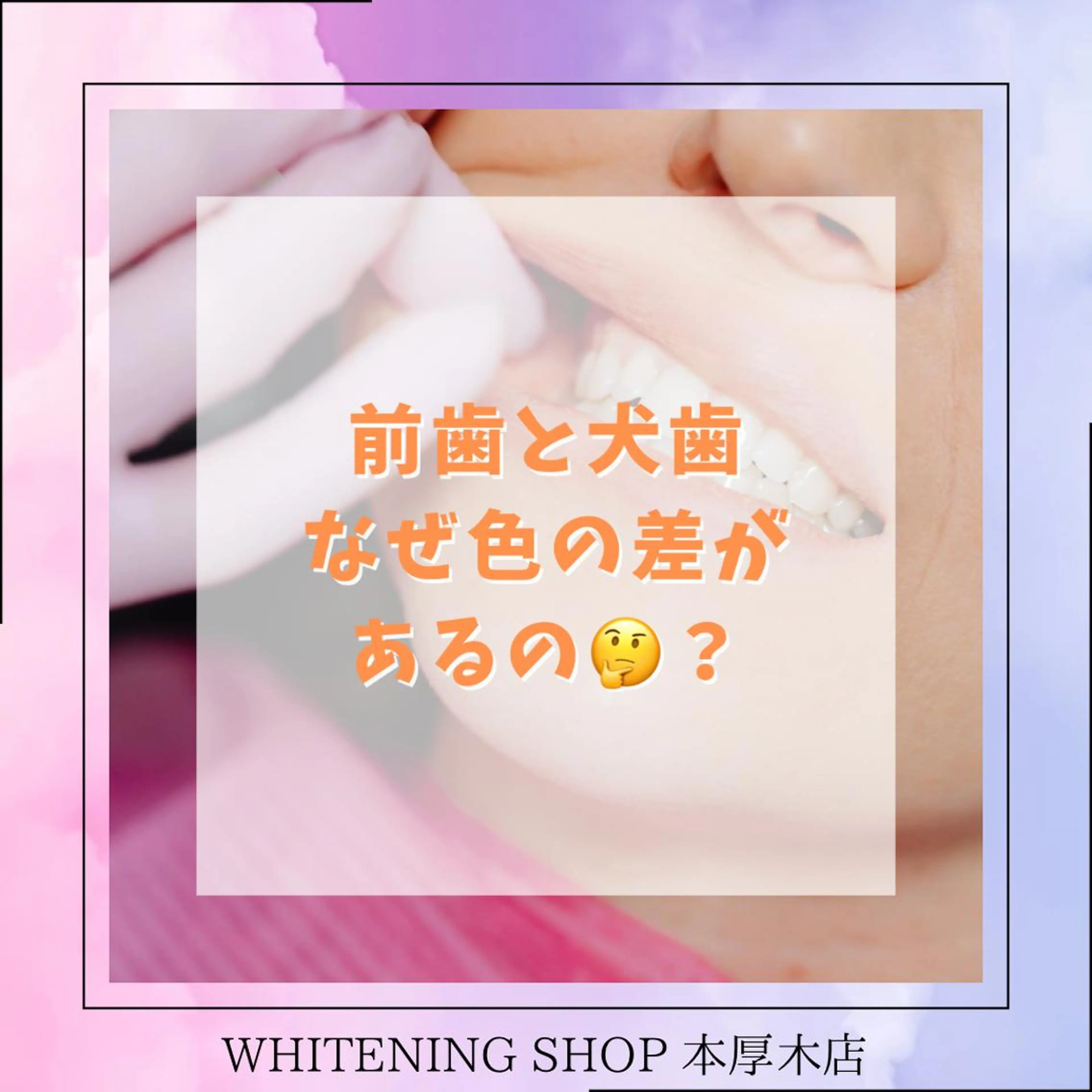 メンズ その他 ホワイトニング ショップ本厚木のその他イメージ
