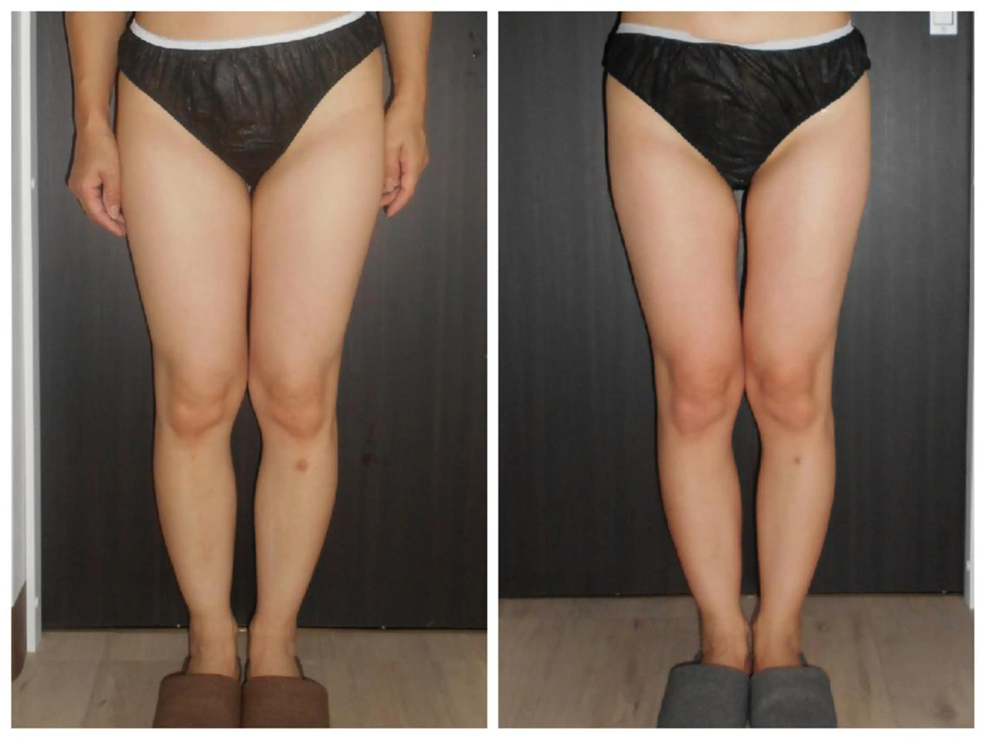 小顔専門店 グレイスボディ三郷店のエステ・リラクイメージ