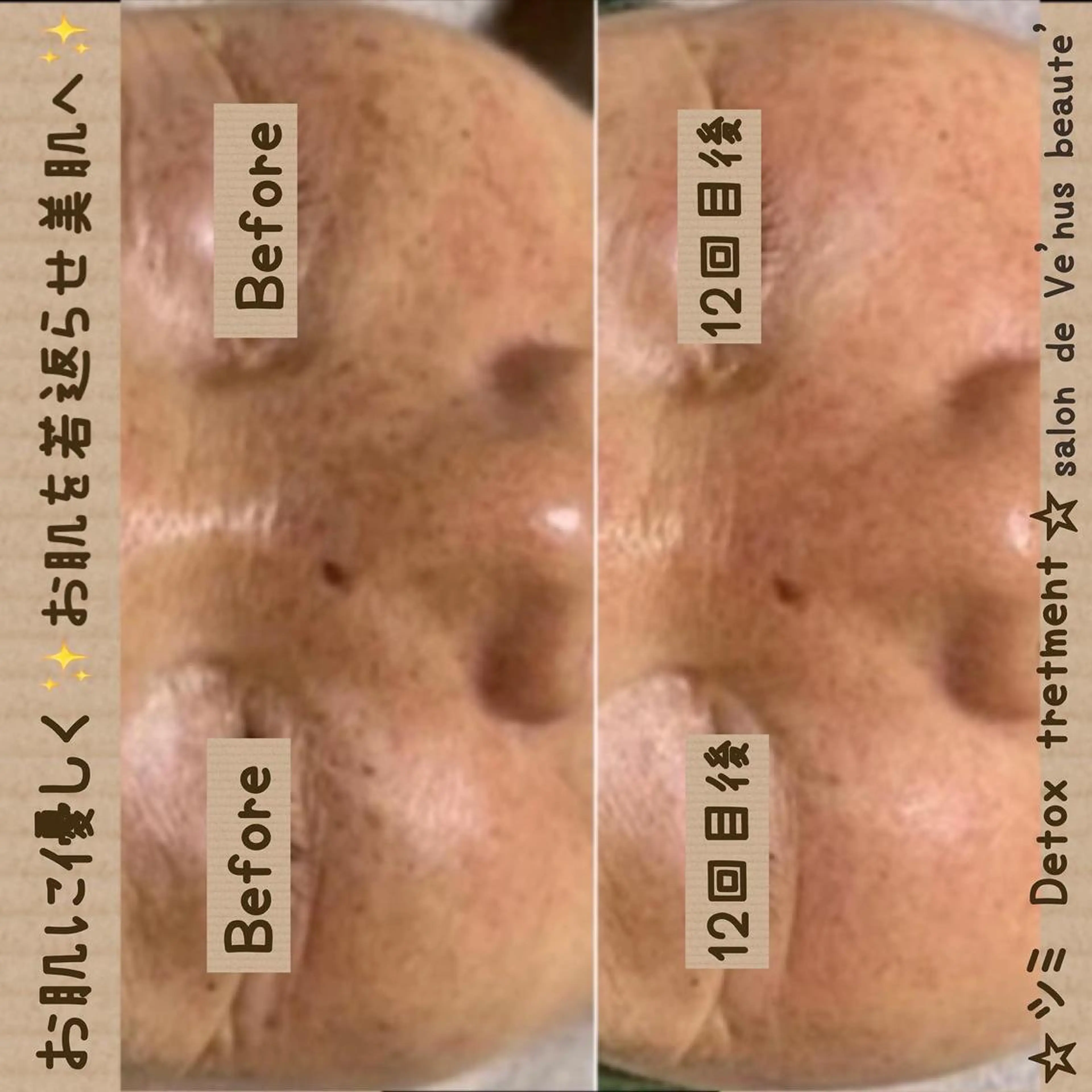 エステ ヴィーナス ビューティーのエステ・リラクイメージ