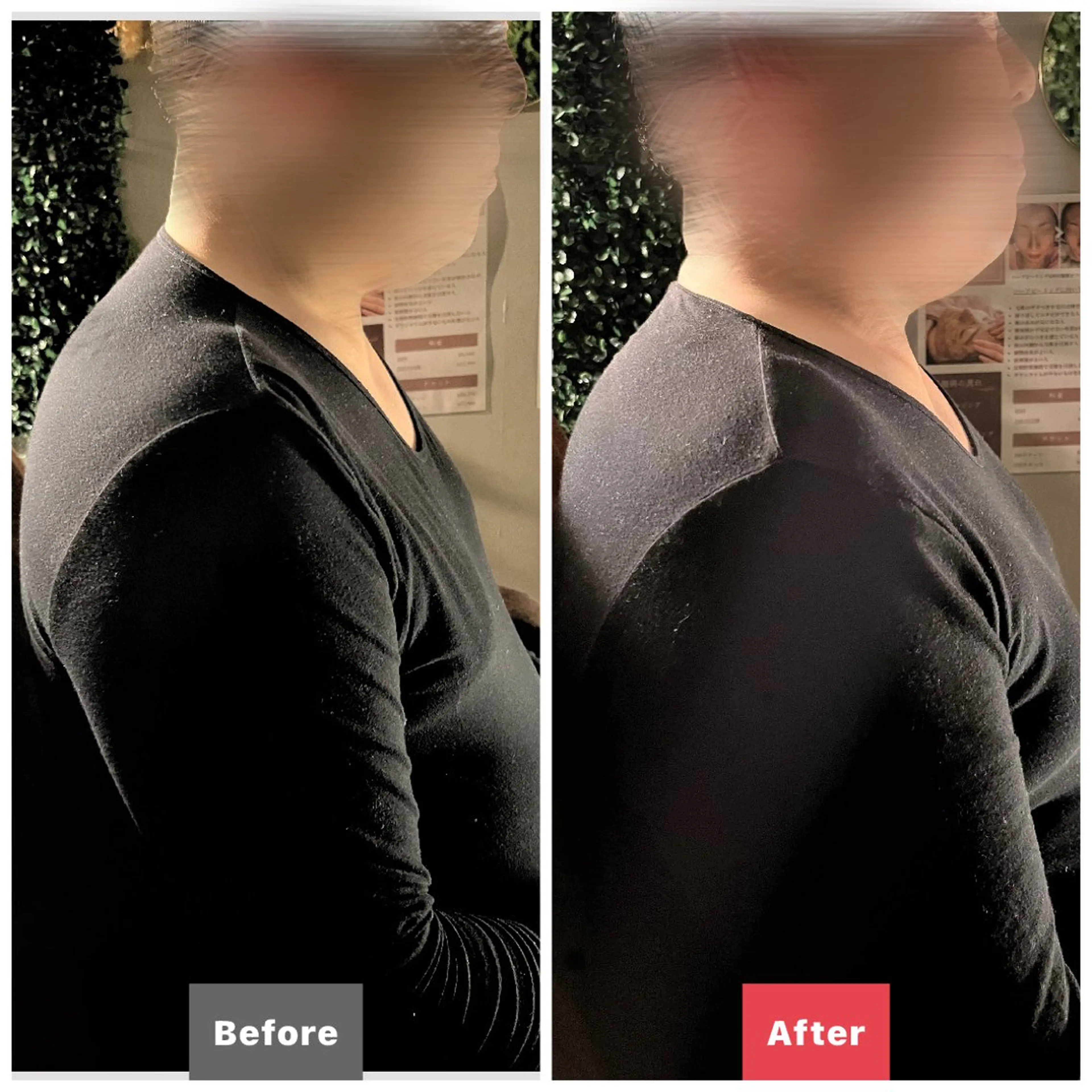 男女兼用脱毛&ドライ ヘッドスパ トレテルのエステ・リラクイメージ