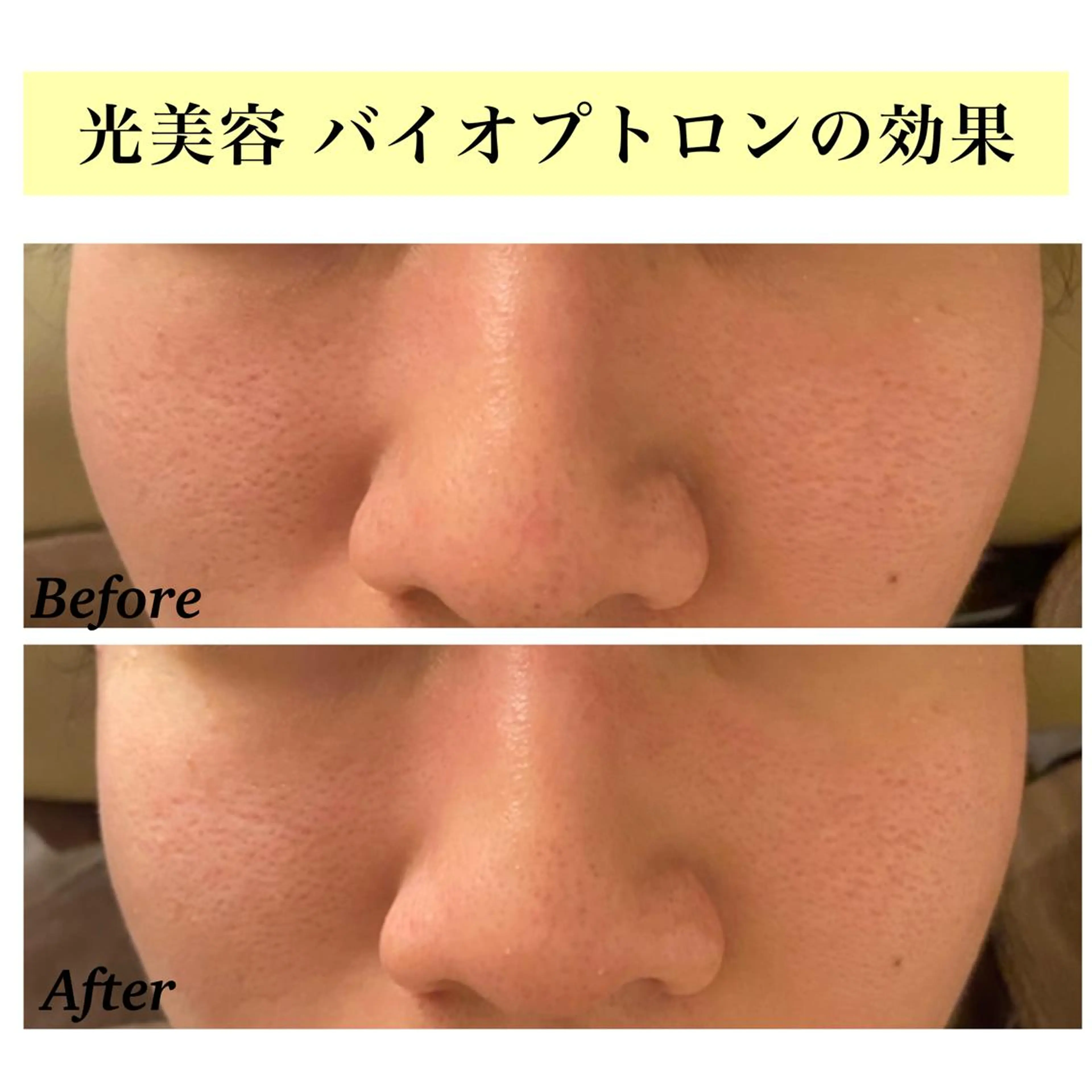 エステ リラク Bellesthe (ベルエステ)のエステ・リラクイメージ