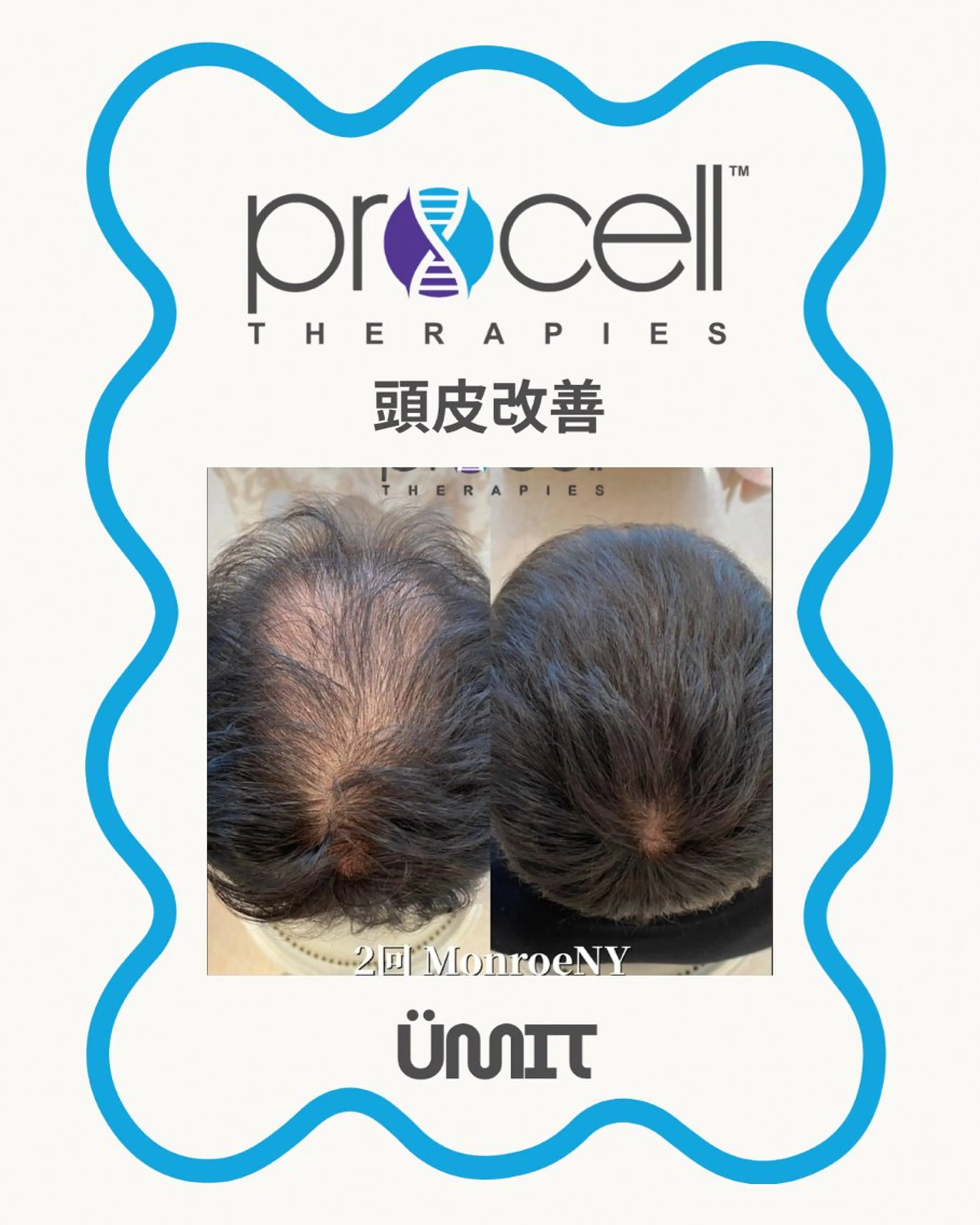 メンズ ヘッドスパ Ümit（ユミト） プロセルセラピーズのネイルデザイン