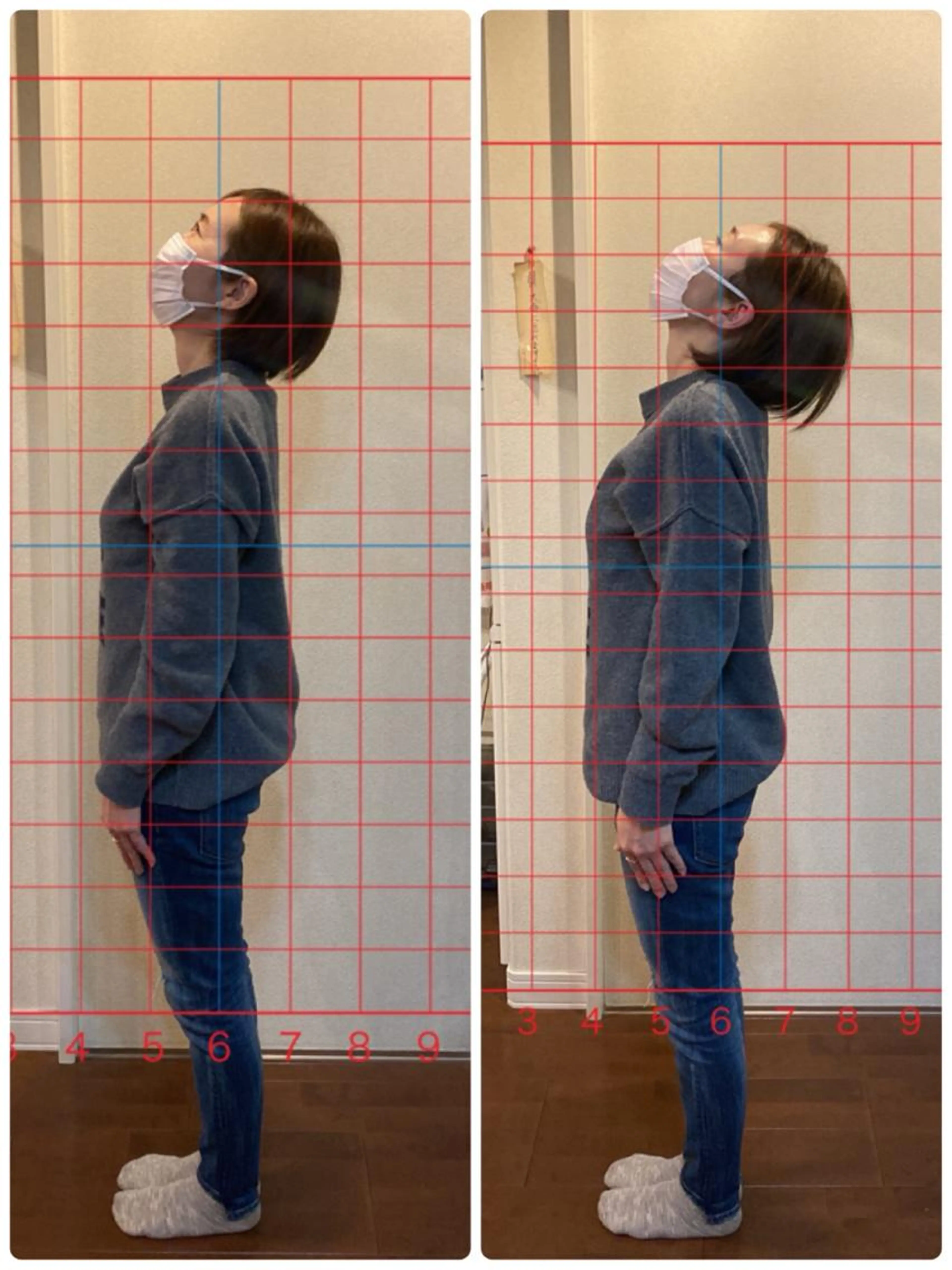 カイロプラクティック体験施術の写真