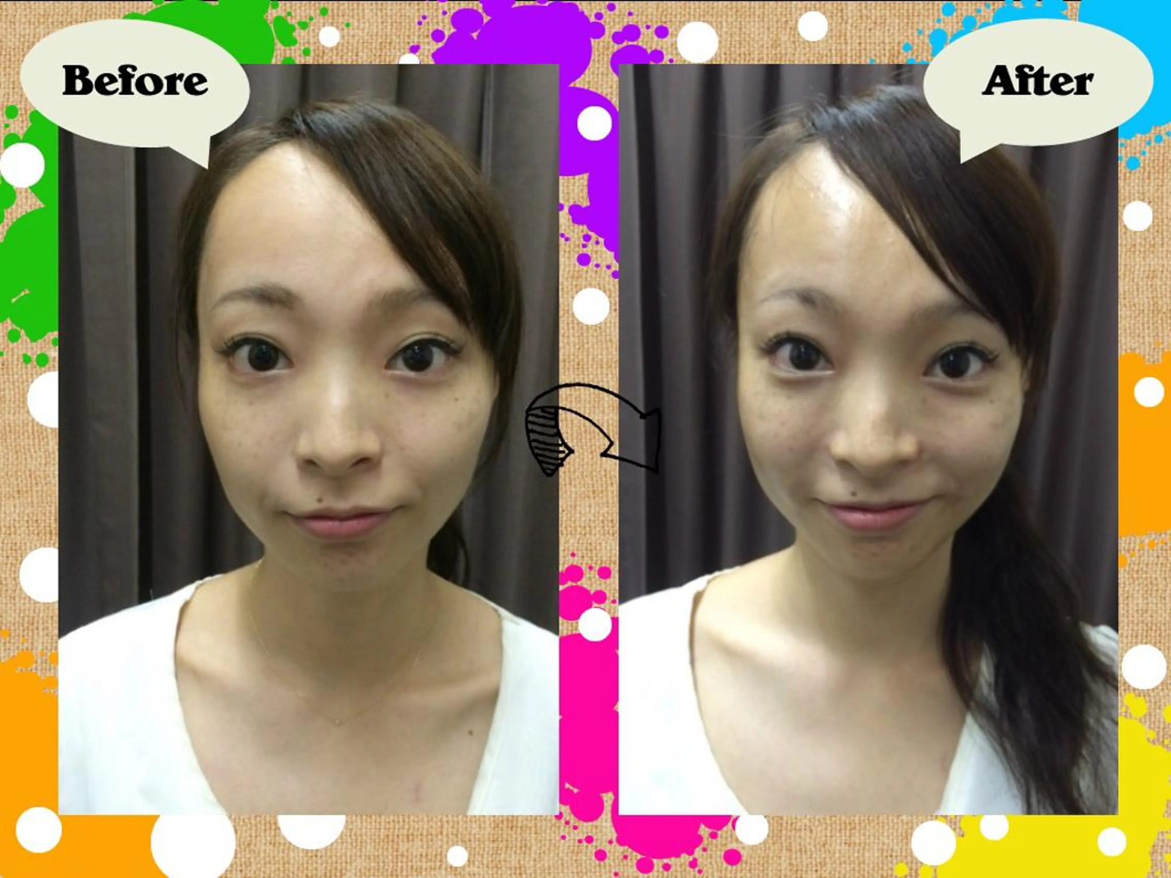 上田式美容鍼灸®️の写真