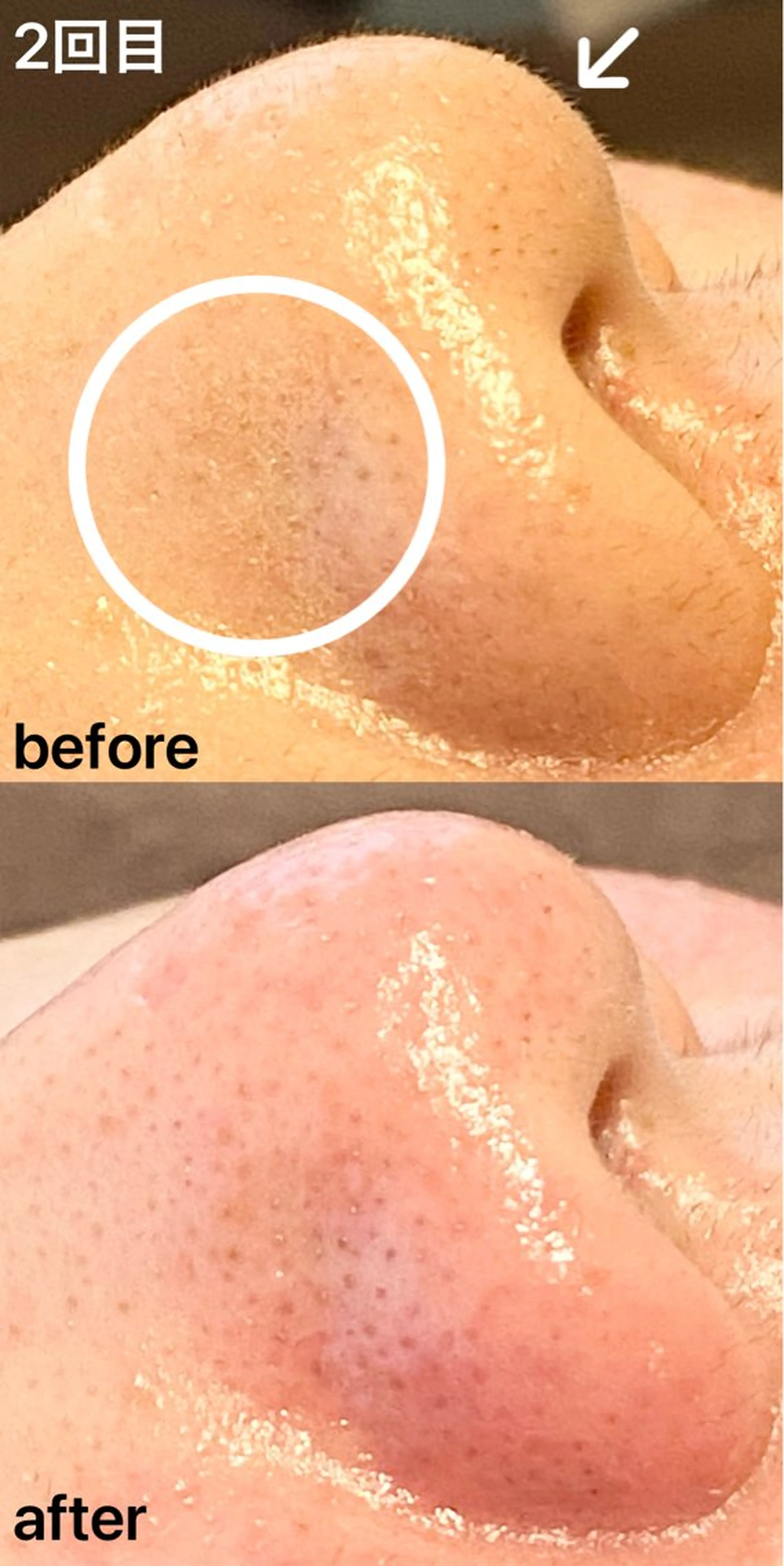 眉毛×小顔矯正サロン パピヨンsakiのエステ・リラクイメージ