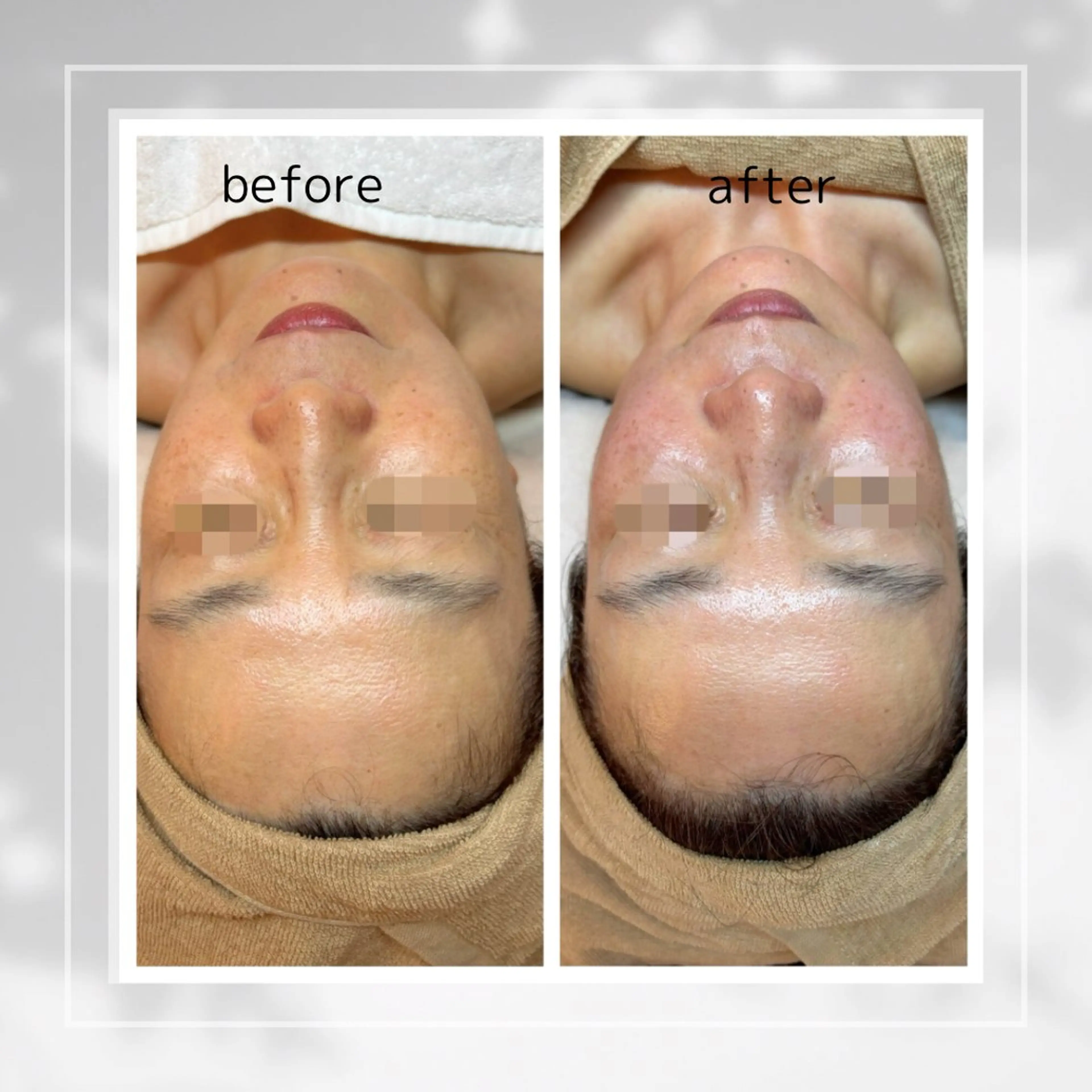 エステ 肌質改善フェイシャルCLEAR栄生/リンパ/毛穴/シミケア所属・井戸 麻衣のエステ・リラクイメージ