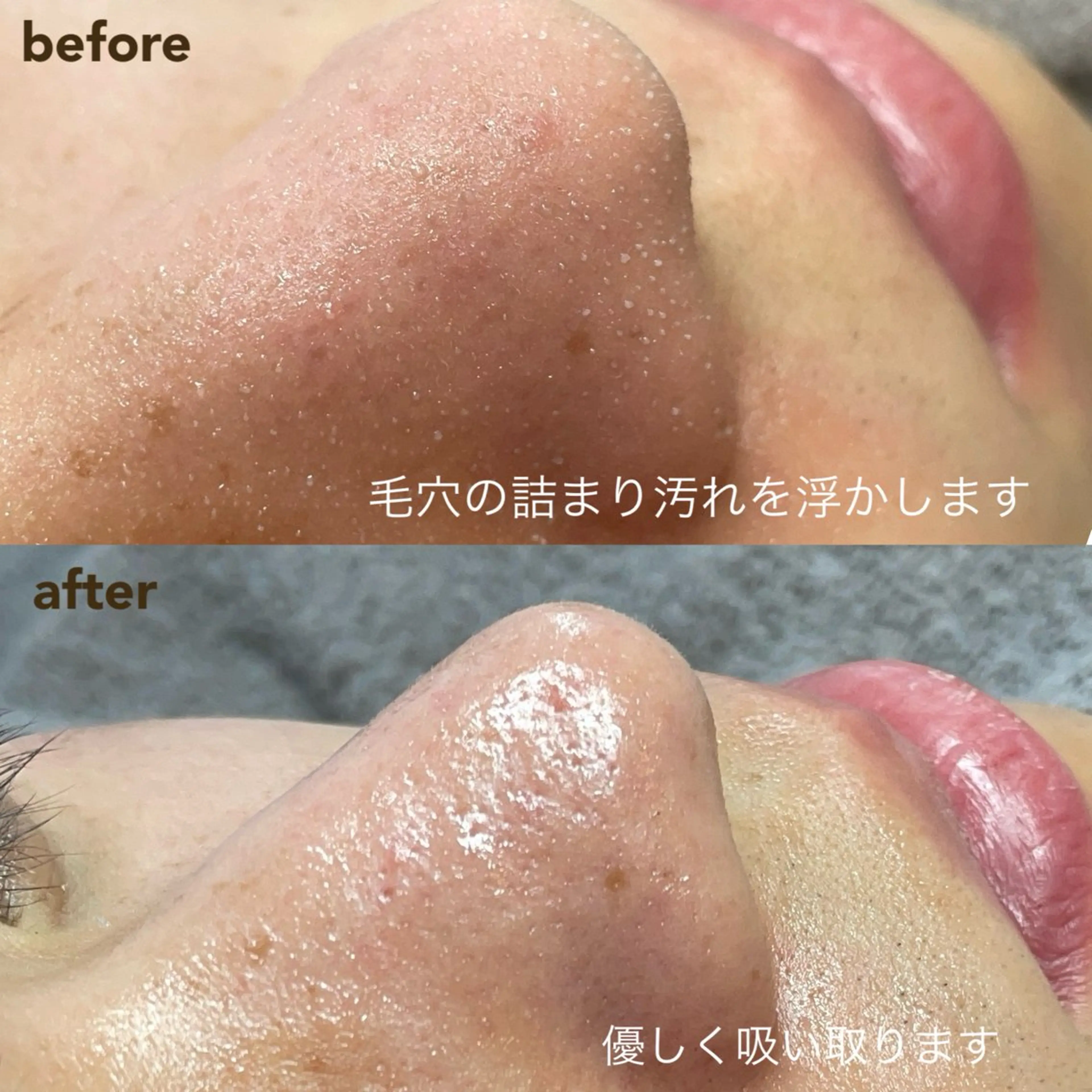 エステ New所属・New __のその他イメージ