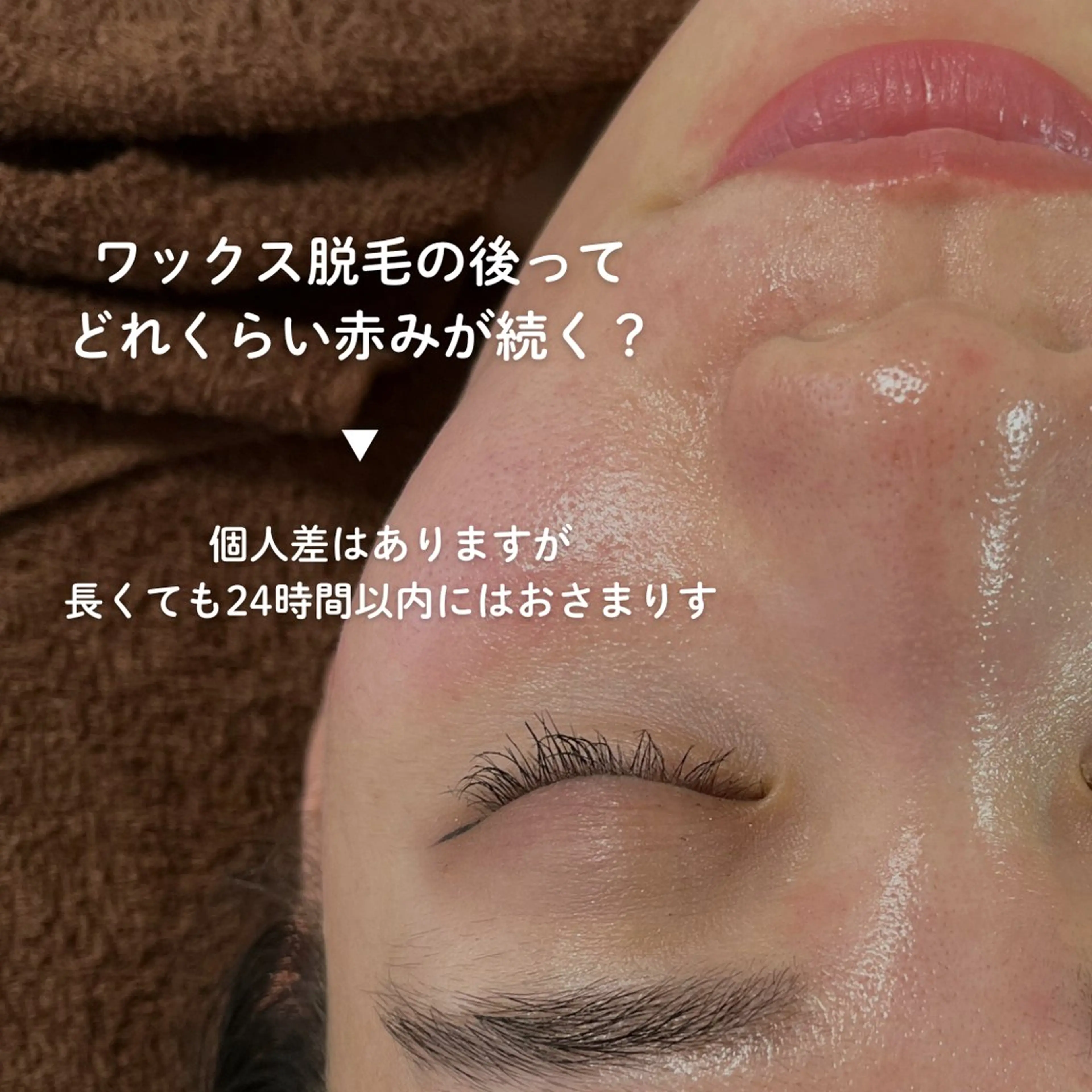 EST BEAUTY所属・顔ワックス脱毛/ ハーブピーリングのエステ・リラクイメージ