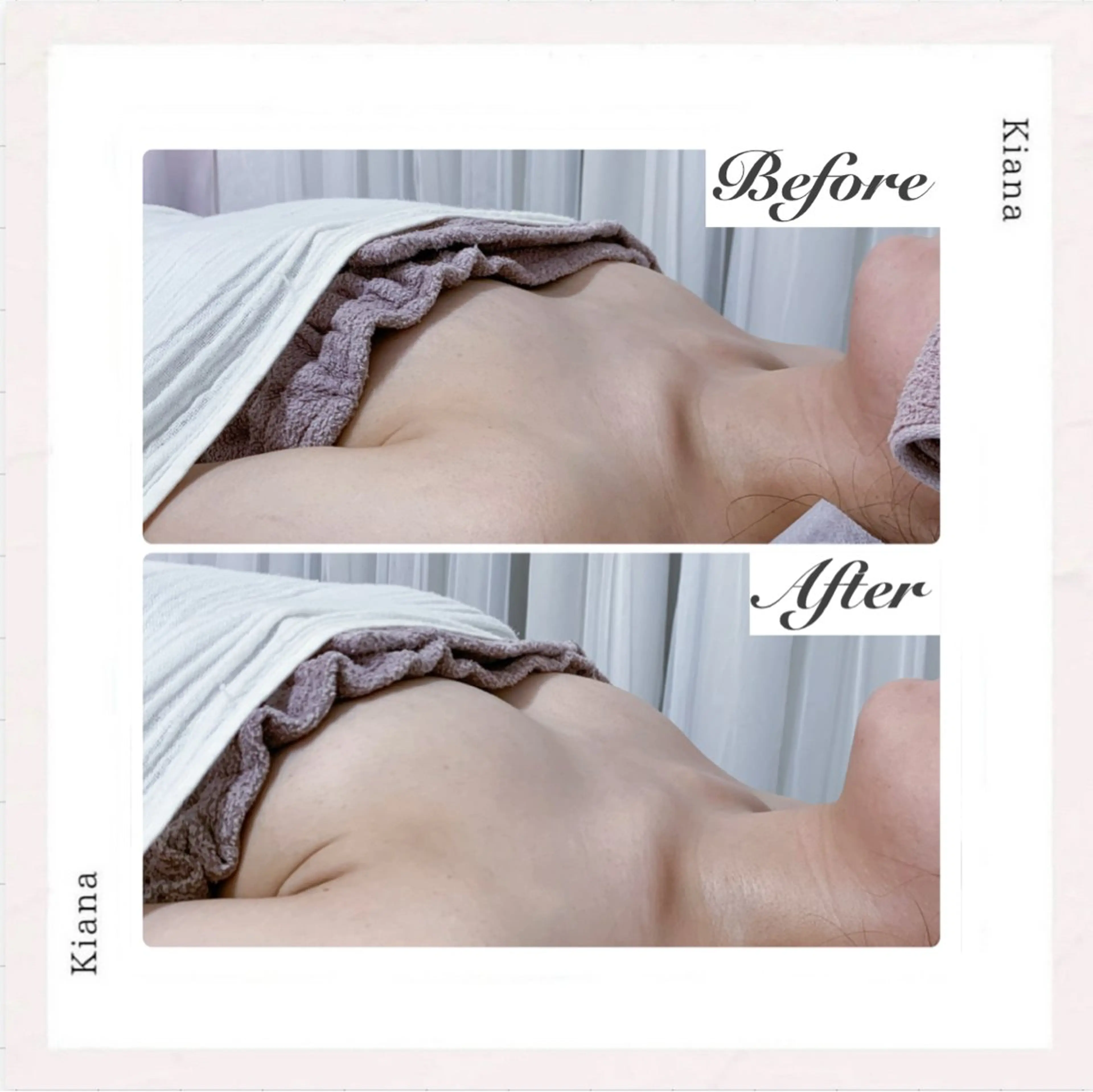 エステ リラク バスト専門Kiana 風のエステ・リラクイメージ