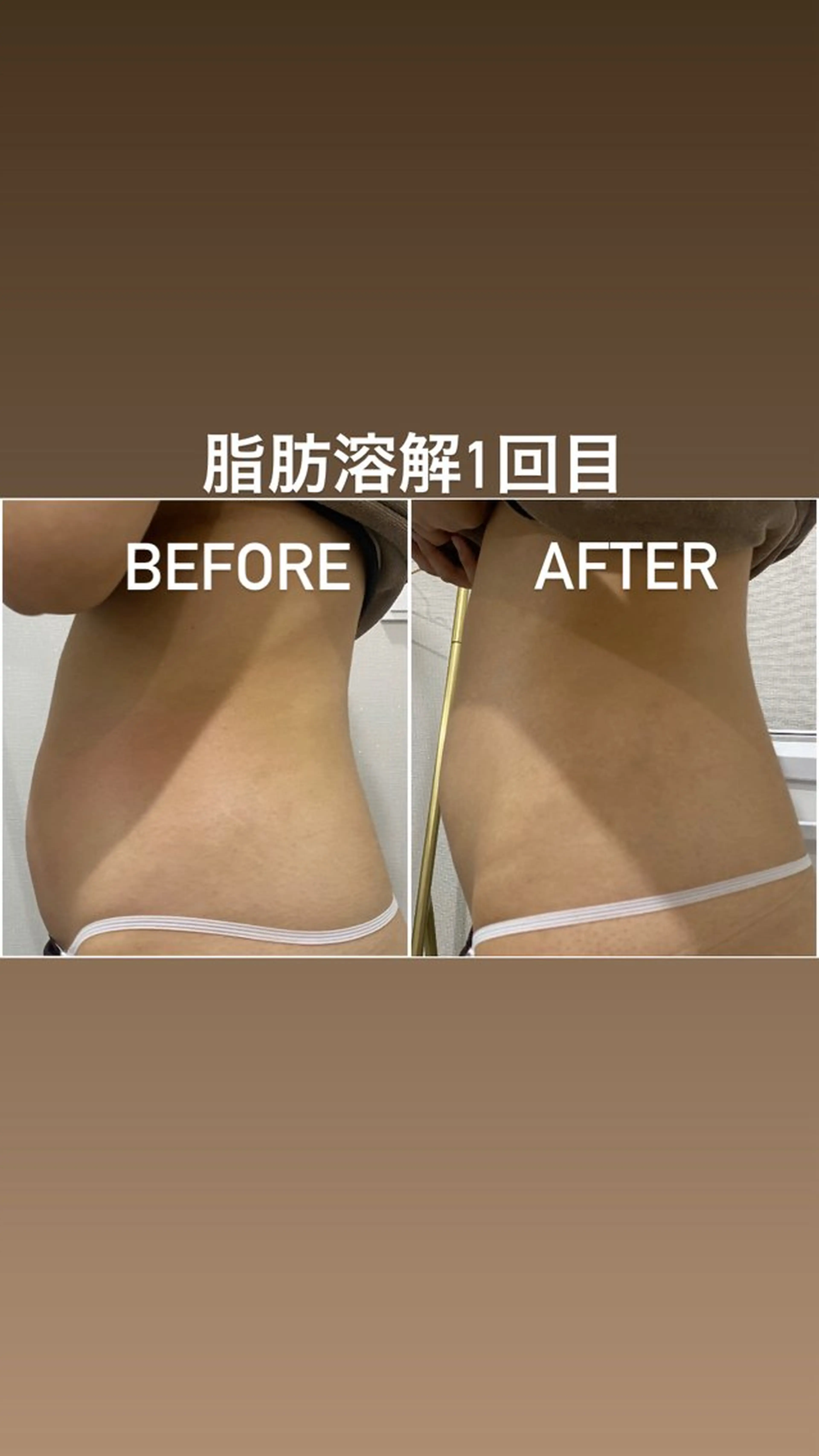 エステ 毛穴洗浄・痩身・脱毛 /アルカンジュのエステ・リラクイメージ